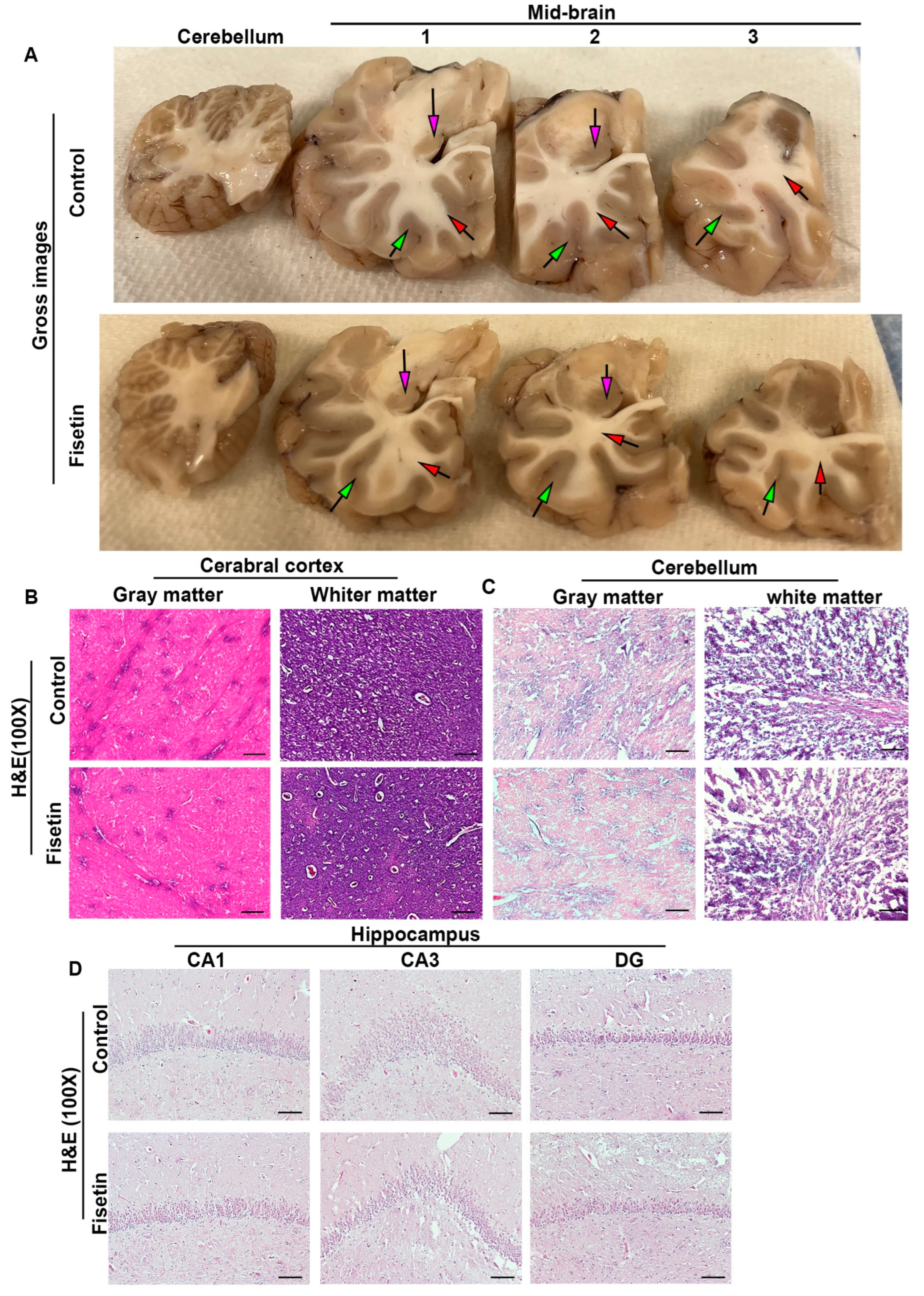 Fisetin is a senotherapeutic that extends health and lifespan - eBioMedicine