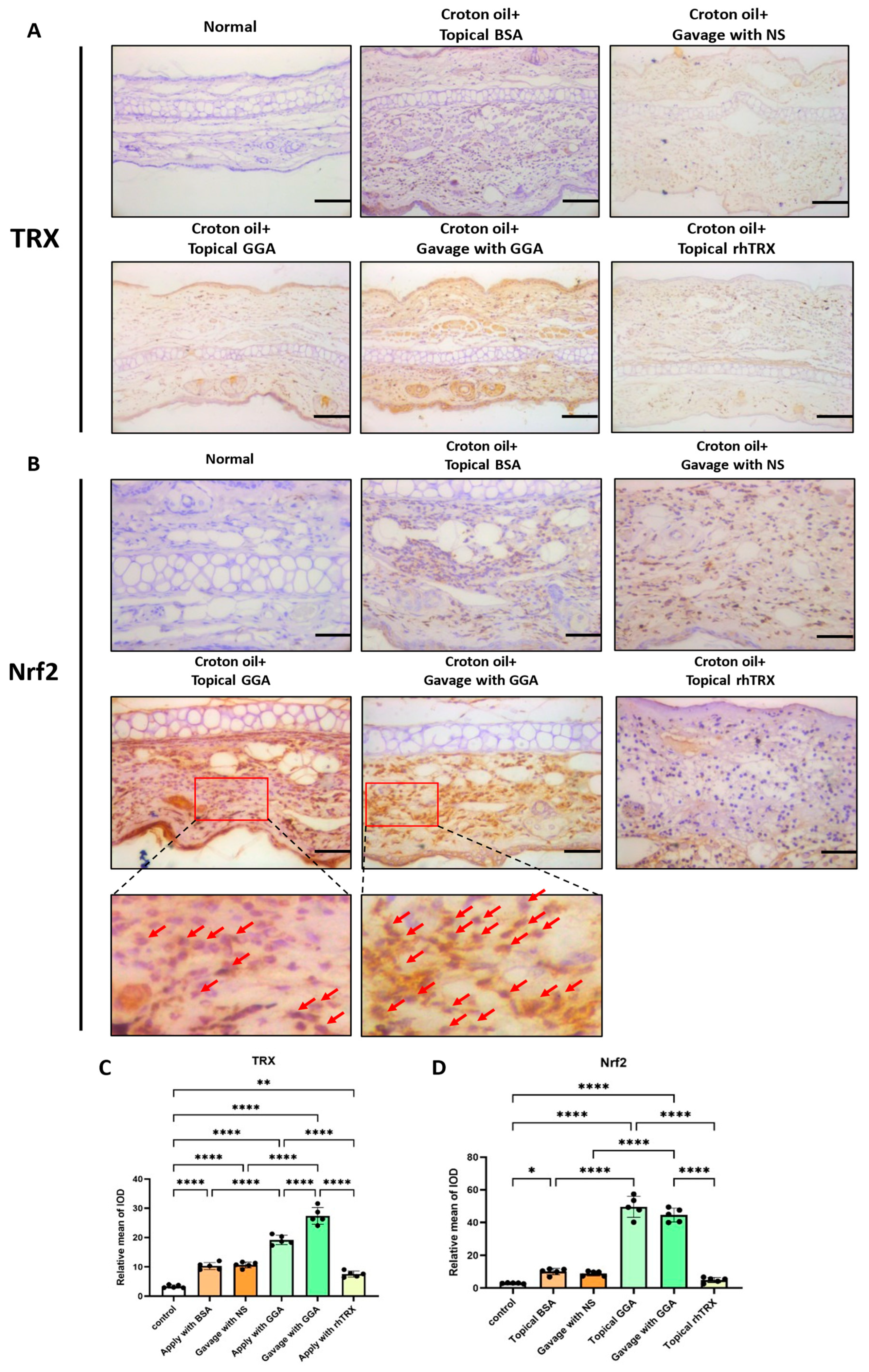 Antioxidants | Free Full-Text | Geranylgeranylacetone Ameliorates