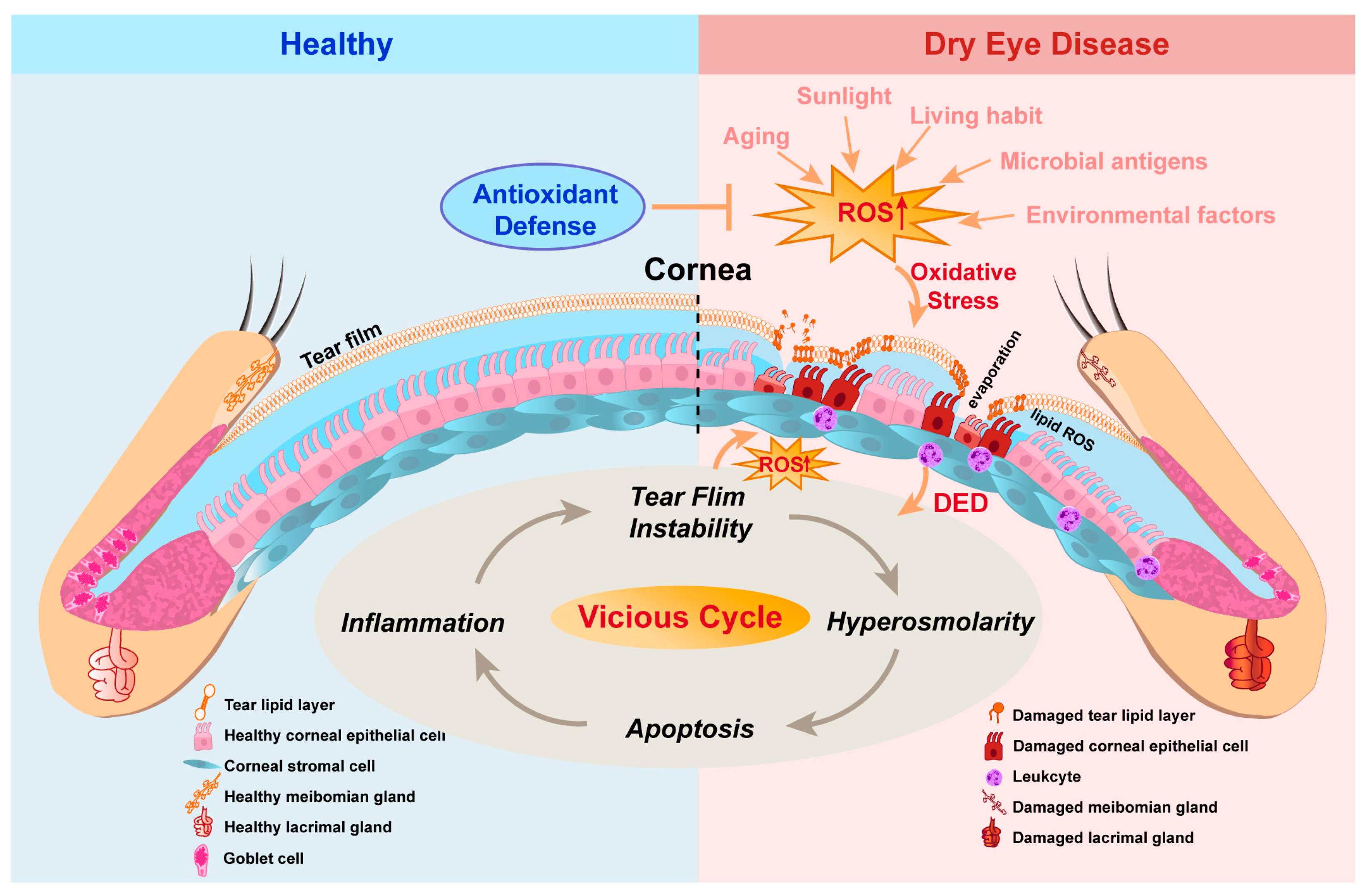 Antioxidants | Free Full-Text | Potential New Target for Dry Eye  Disease—Oxidative Stress