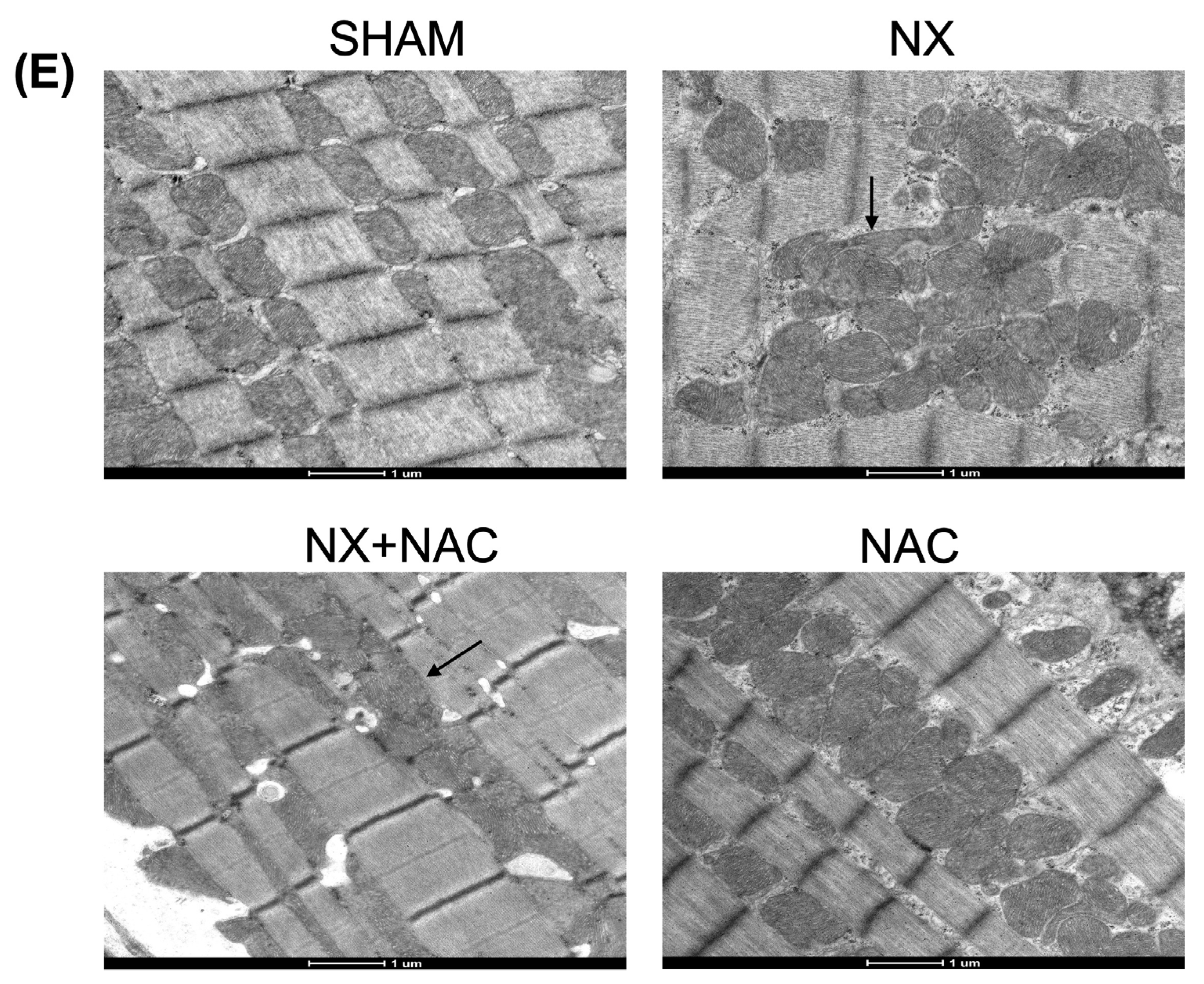 Antioxidants 14 00367 g007b
