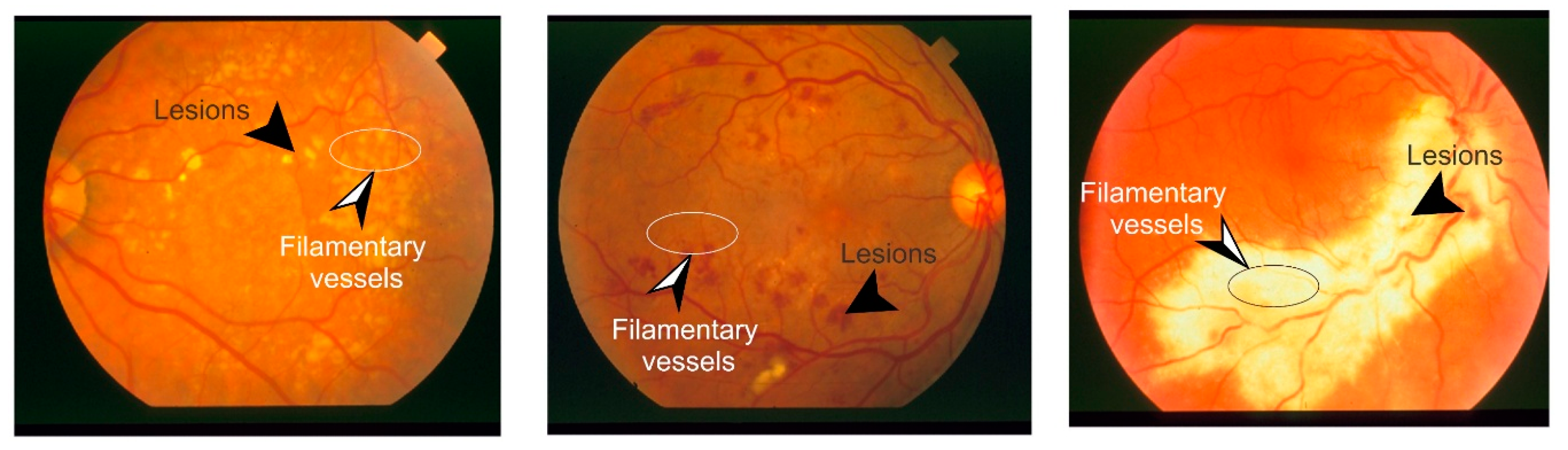 Applied Sciences Free Full Text Retinal Vessels Segmentation - no