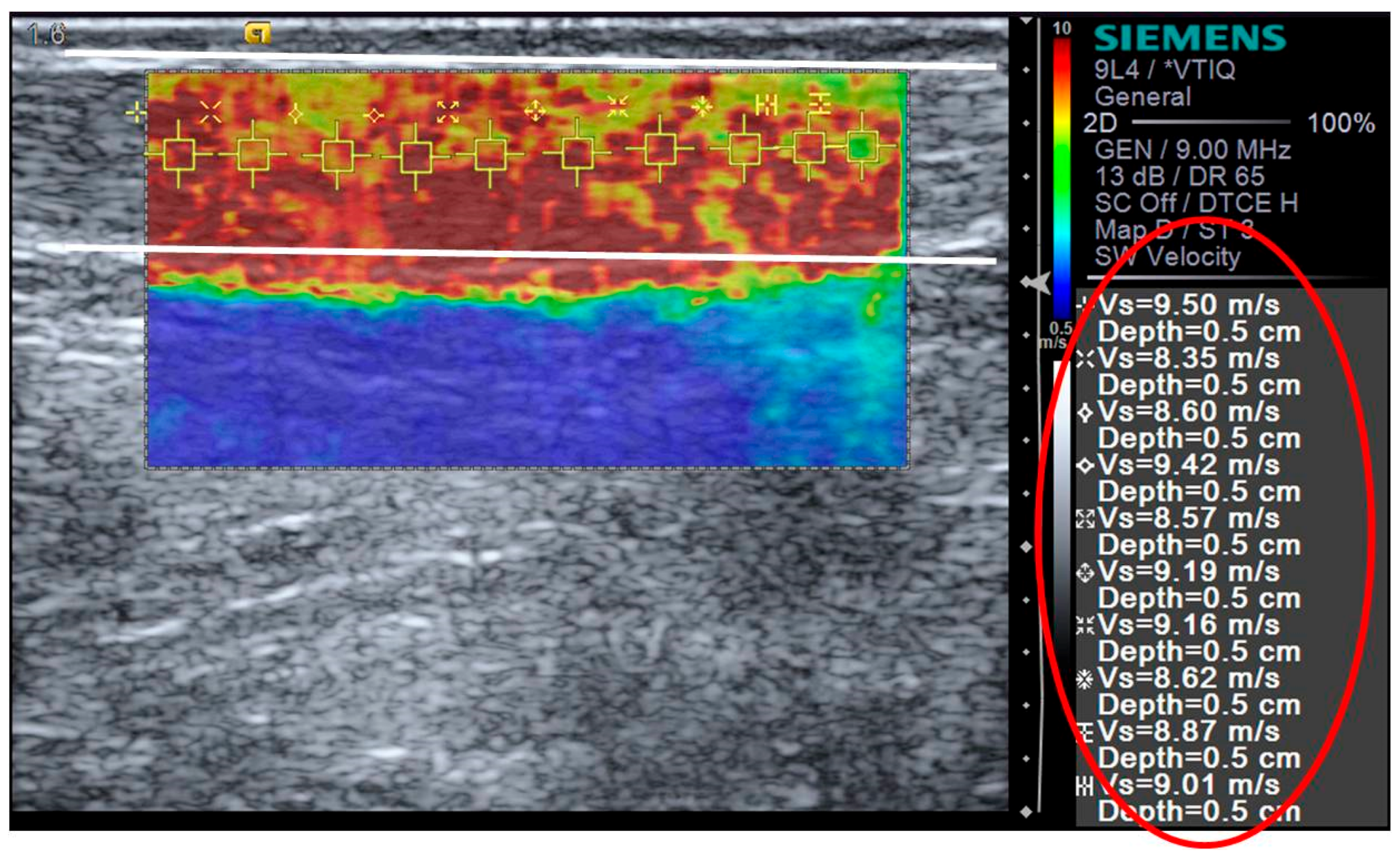 Applied Sciences Free Full Text Shear Wave Elastography Measures Of The Achilles Tendon Influence Of Time Of Day Leg Dominance And The Impact Of An Acute 30 Minute Bout Of Running Html