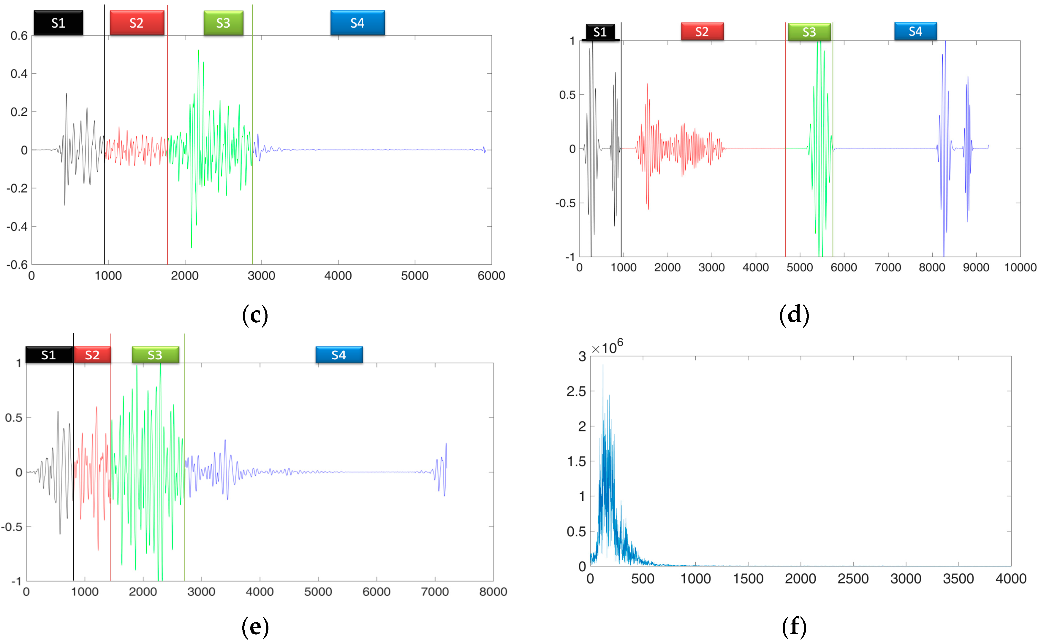 Applied Sciences Free Full Text Classification Of Heart Sound Signal Using Multiple Features Html