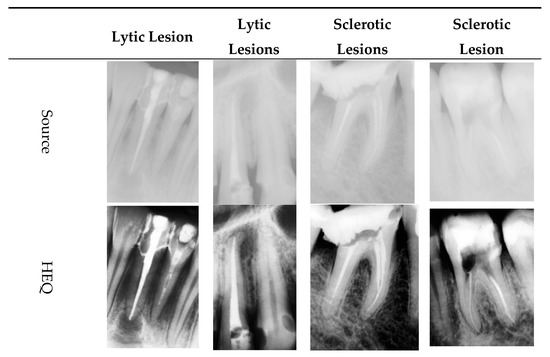 Applied Sciences Free Full Text Use Of Texture Feature Maps For The Refinement Of Information Derived From Digital Intraoral Radiographs Of Lytic And Sclerotic Lesions Html