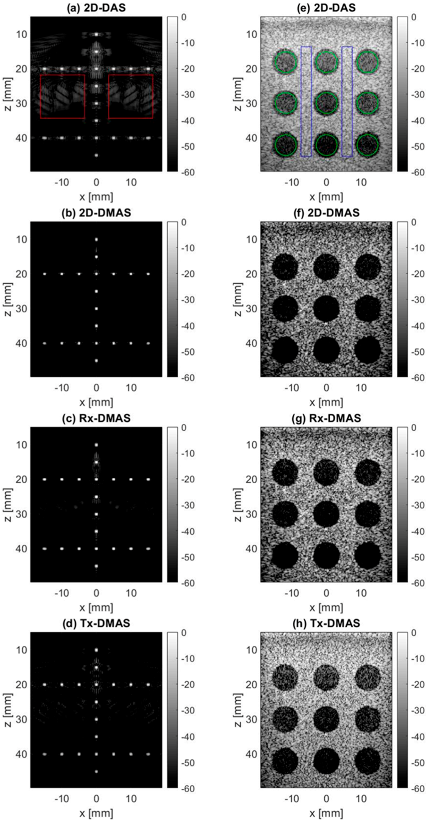 Applied Sciences Free Full Text Two Dimensional Spatial Coherence For Ultrasonic Dmas Beamforming In Multi Angle Plane Wave Imaging Html