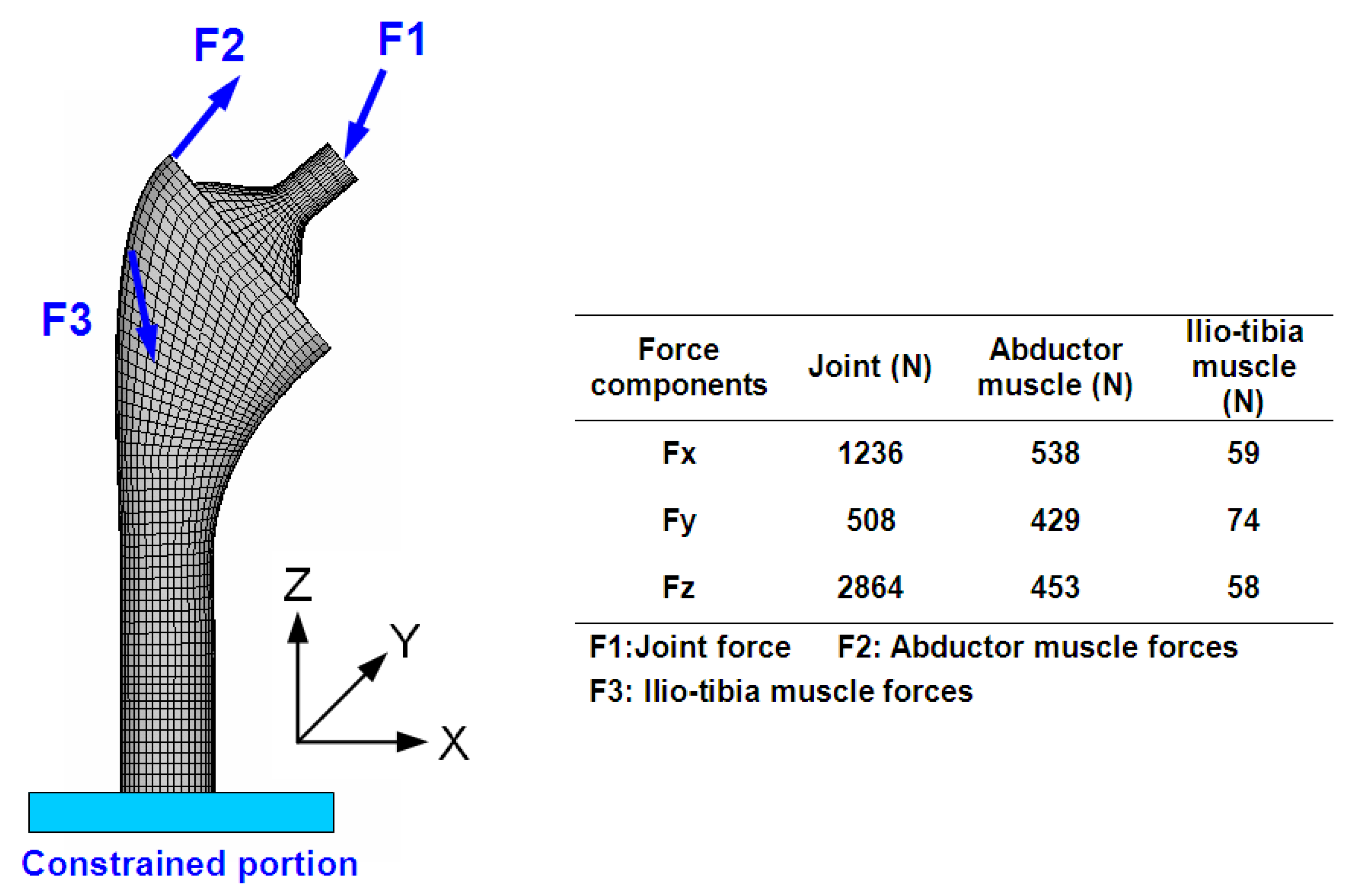 Applied Sciences Free Full Text Biomechanical Performance Of The Cemented Hip Stem With