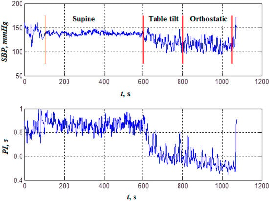 Applied Sciences Free Full Text Quantification Of The Feedback Regulation By Digital Signal Analysis Methods Application To Blood Pressure Control Efficacy Html