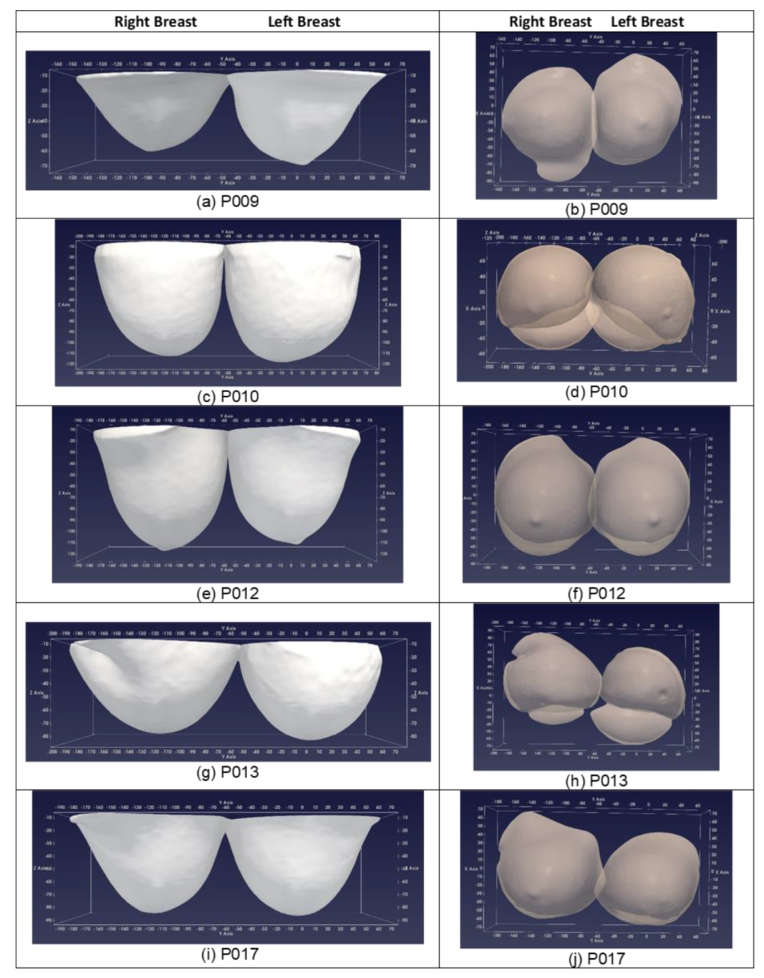 breast contour definition