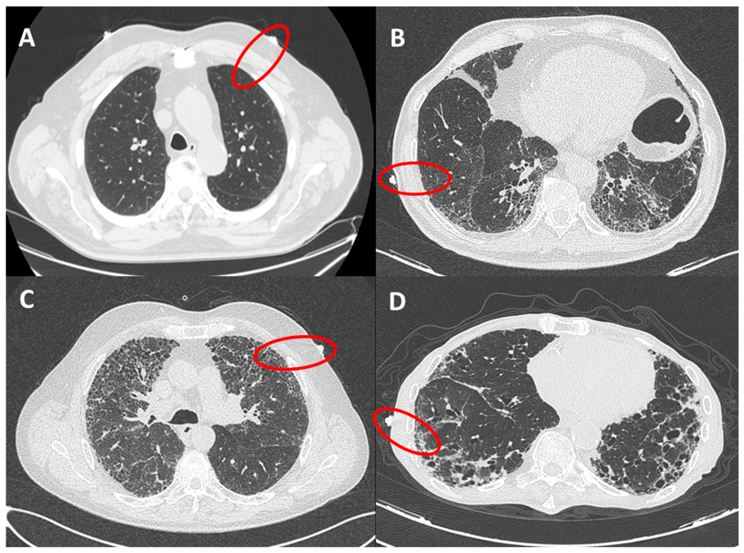 Applsci 10 01617 g002
