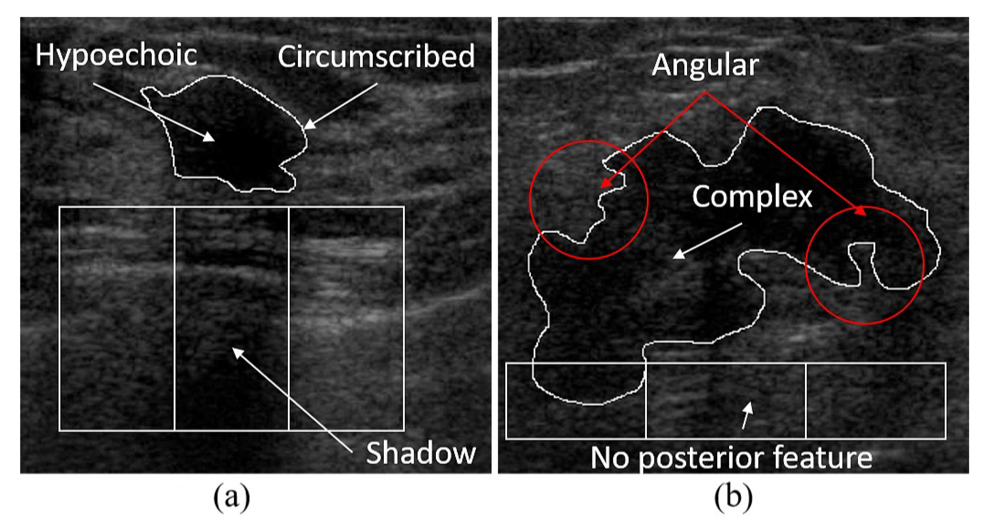 Applied Sciences | Free Full-Text | A Novel Computer-Aided-Diagnosis System  for Breast Ultrasound Images Based on BI-RADS Categories