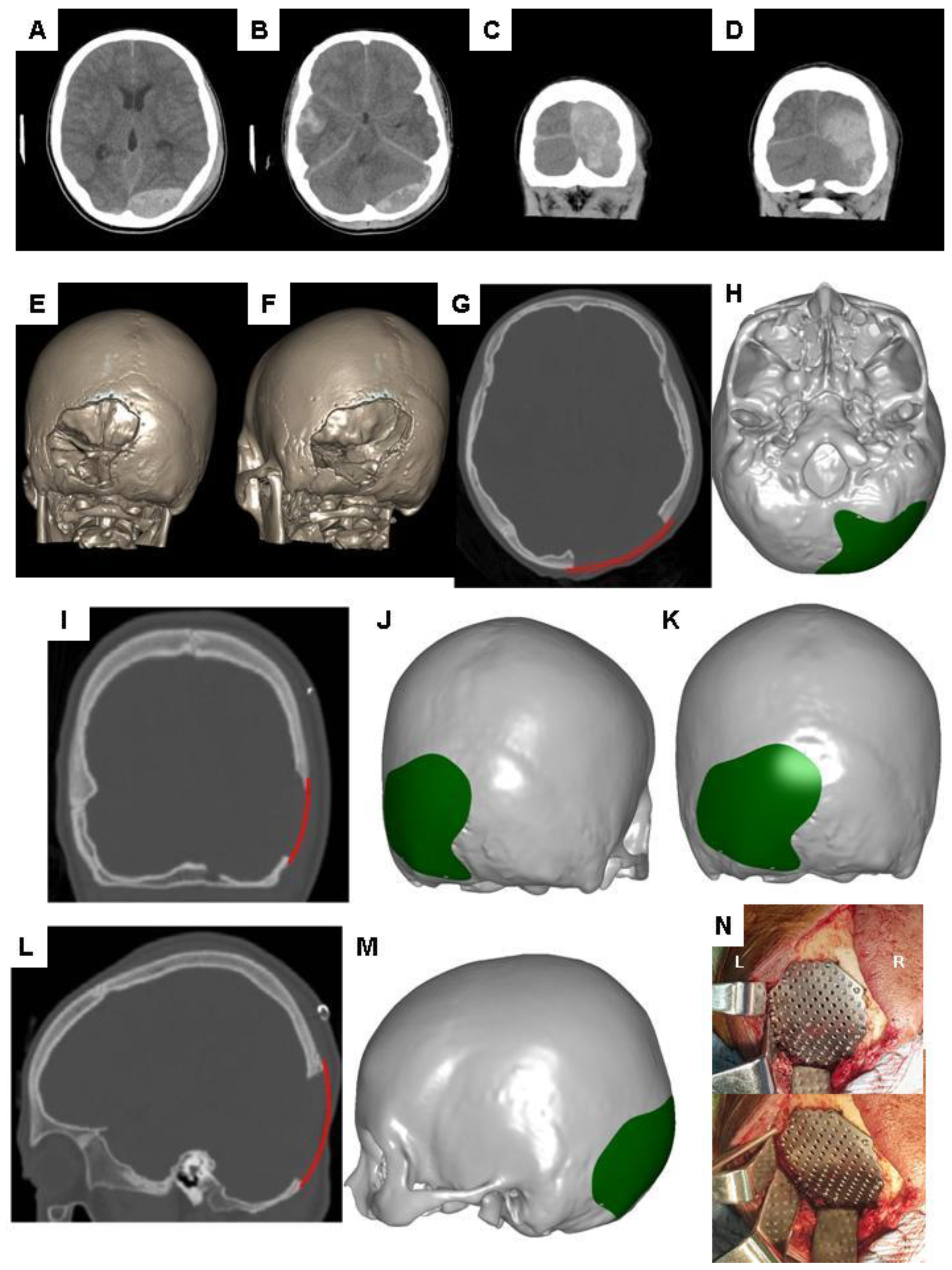 Applsci 10 01847 g003 Applsci 10 01847 g003