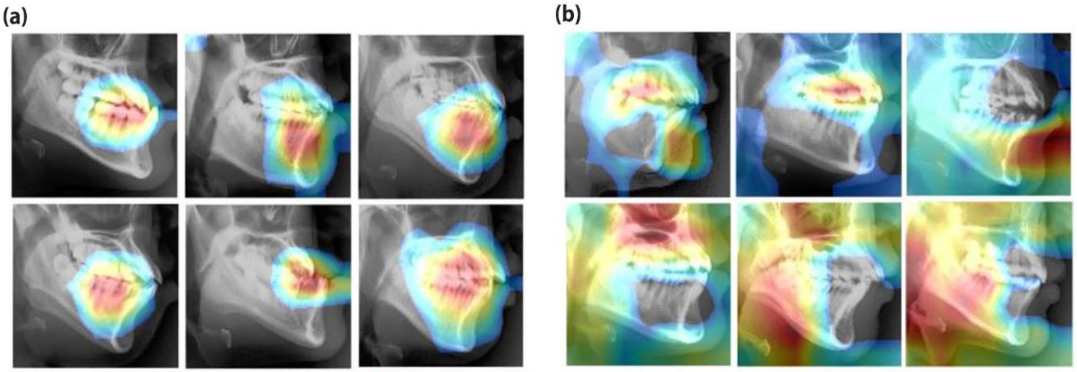 Applsci 10 02124 g005