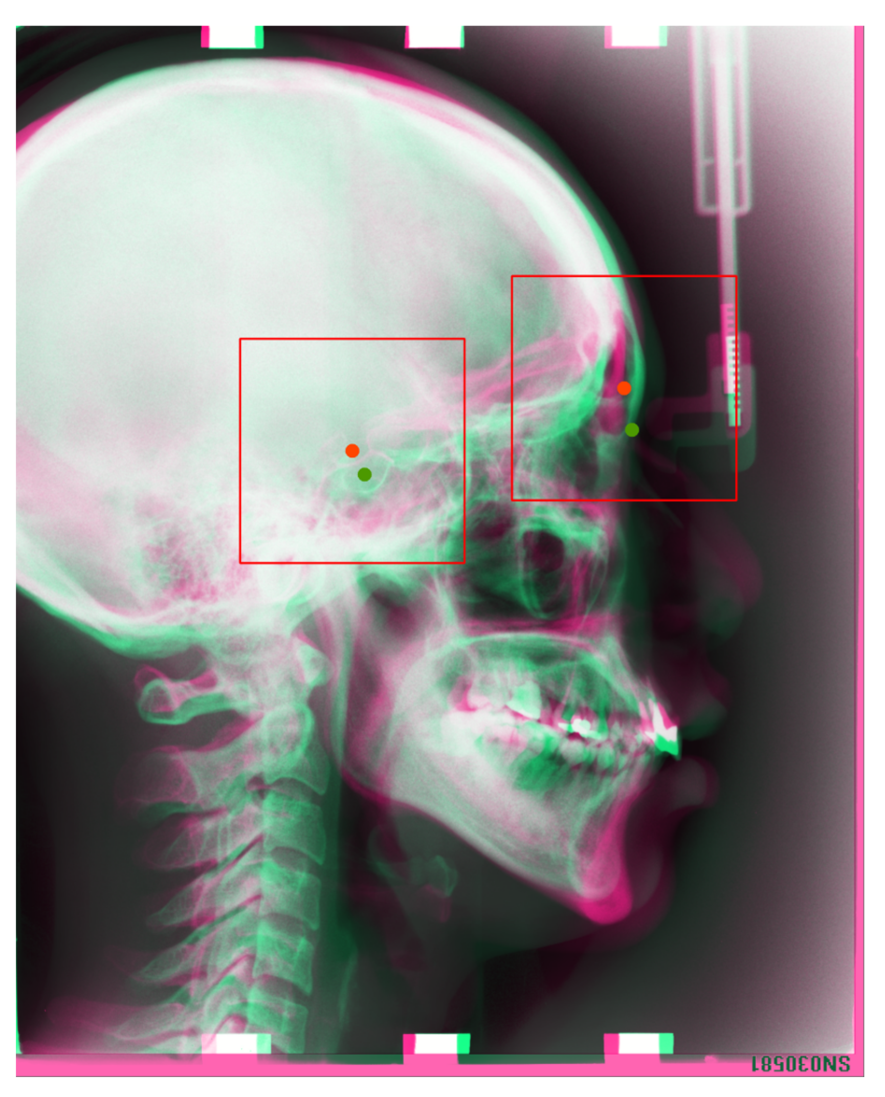 Applied Sciences Free Full Text Automatic Cephalometric Landmark Detection On X Ray Images