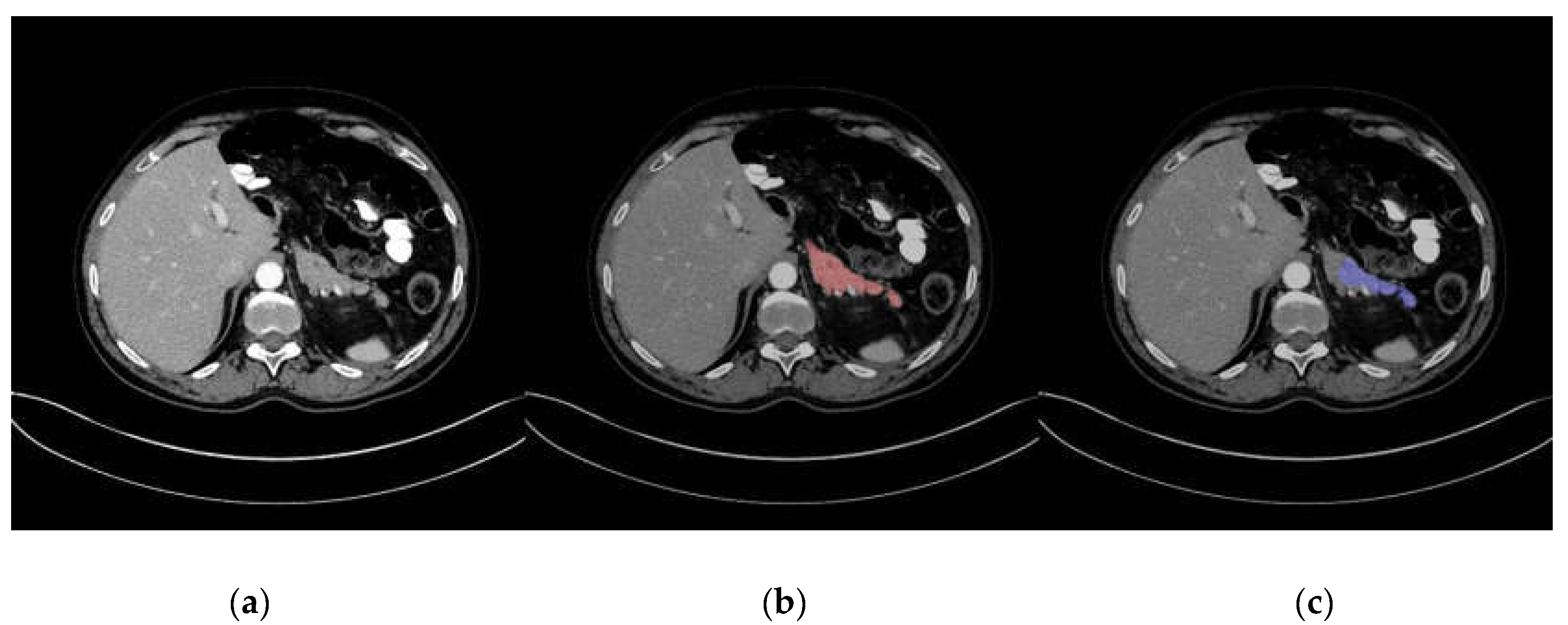 Applsci 10 03360 g003