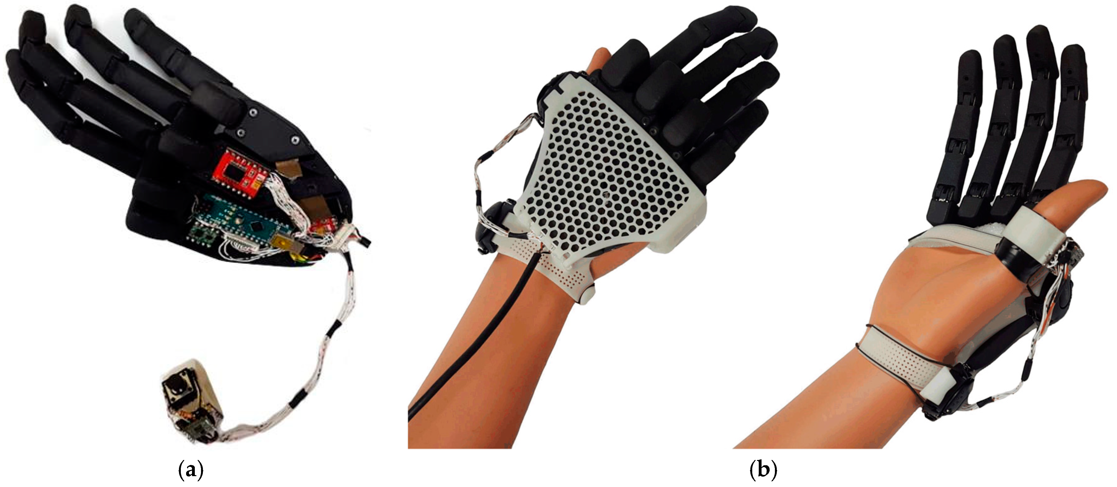 Applied Sciences | Free Full-Text | Development of a Lightweight Prosthetic  Hand for Patients with Amputated Fingers