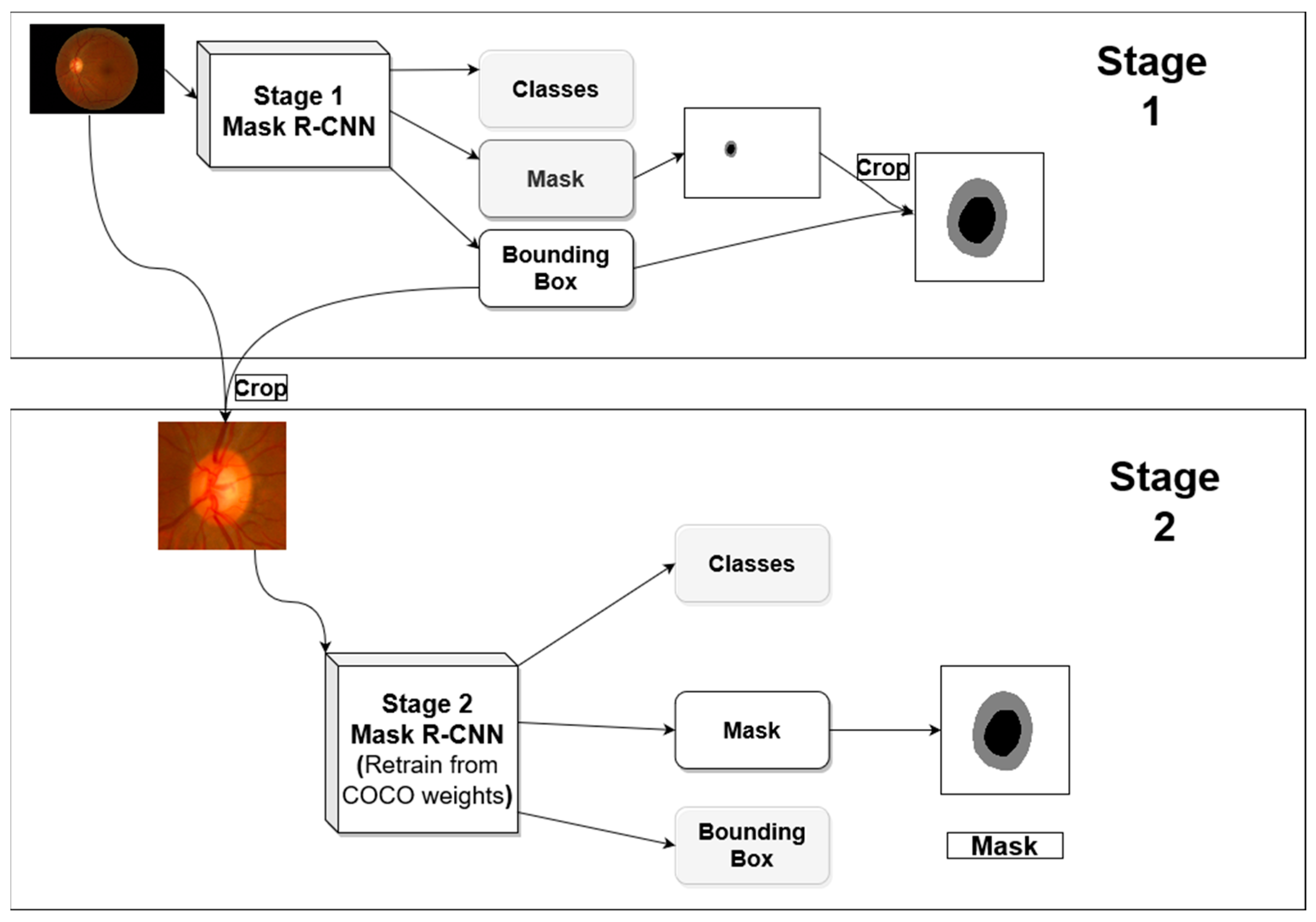 Applied Sciences | Free Full-Text | Two-Stage Mask-RCNN Approach for  Detecting and Segmenting the Optic Nerve Head, Optic Disc, and Optic Cup in  Fundus Images | HTML