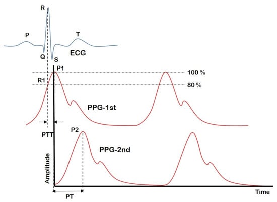 Comparing blood pressure measurements between a photoplethysmography-based  and a standard cuff-based manometry device