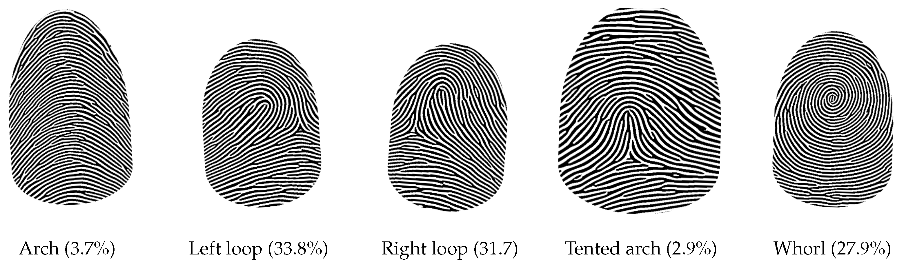 The Whorl fingerprints Patterns