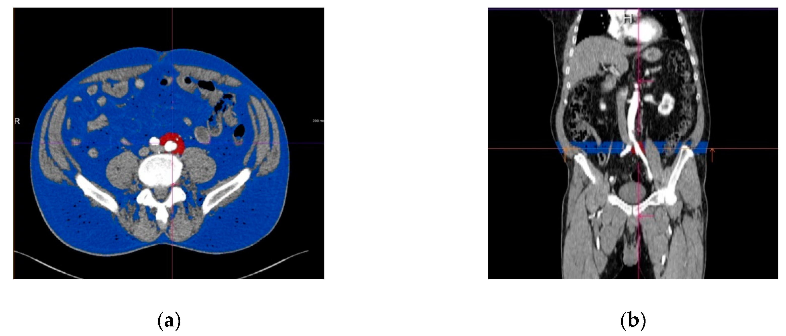 Applsci 10 04456 g002