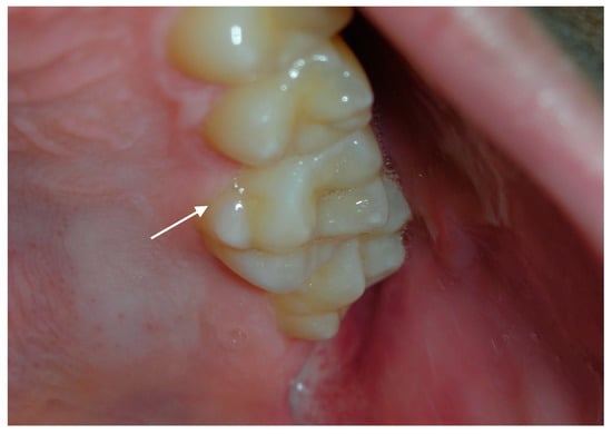 Dental Hygiene Concepts. Extreme Closeup of Female Teenager Mouth