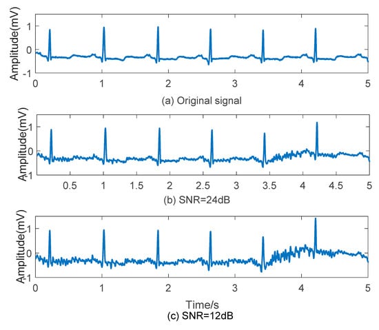 Applied Sciences Free Full Text Ecg Arrhythmia Classification Using High Order Spectrum And 2d Graph Fourier Transform Html