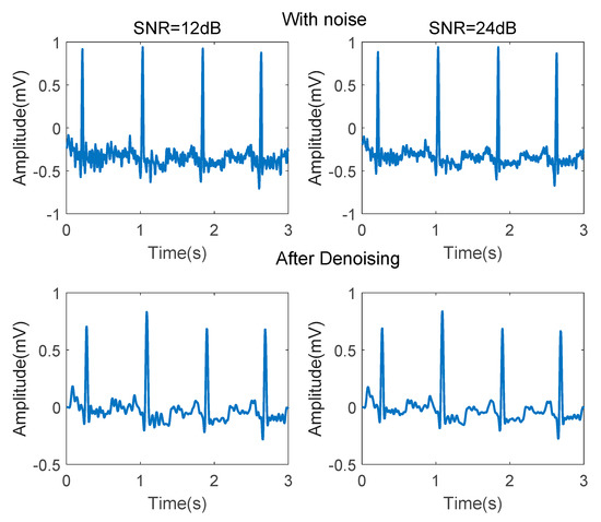 Applied Sciences Free Full Text Ecg Arrhythmia Classification Using High Order Spectrum And 2d Graph Fourier Transform Html