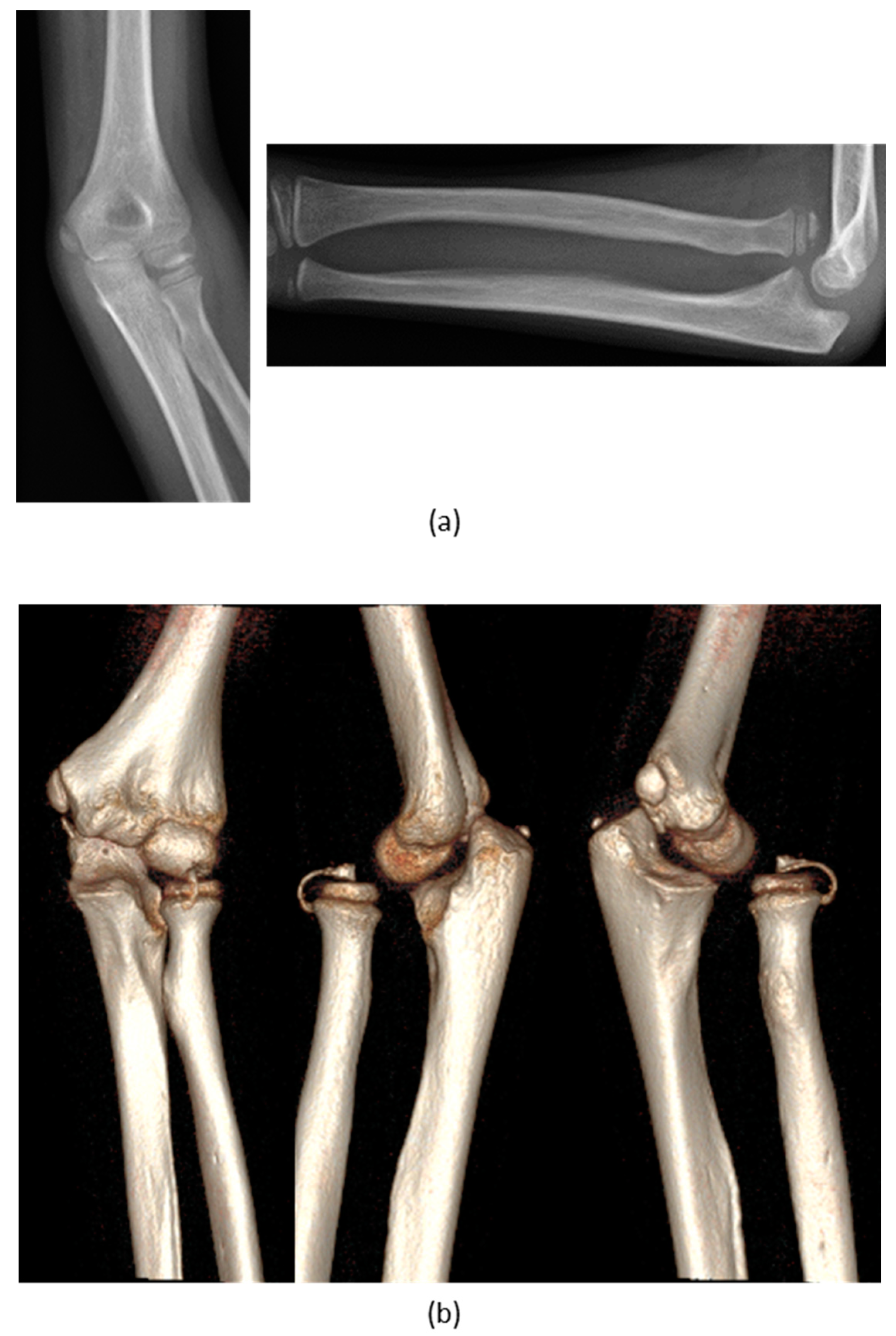 Applsci 10 05181 g004