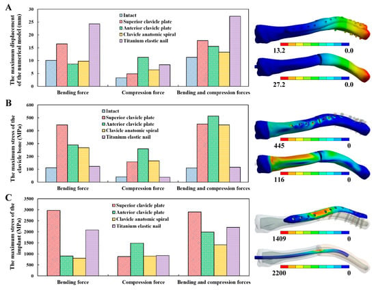 Thirteen models composed of three different clavicle hook plates