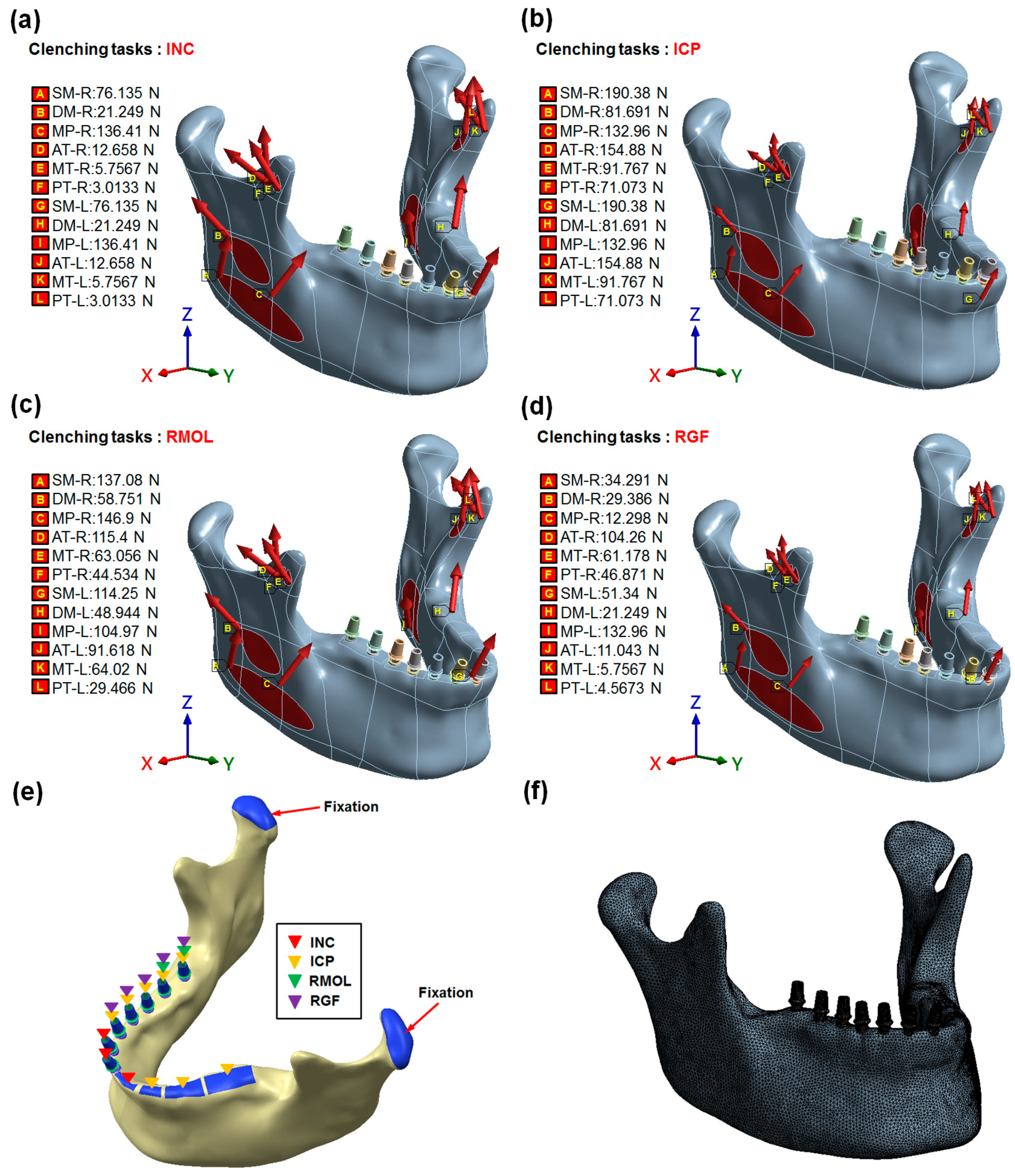 Applied Sciences Free Full Text Biomechanical Design Application On The Effect Of Different Occlusion Conditions On Dental Implants With Different Positions A Finite Element Analysis Html