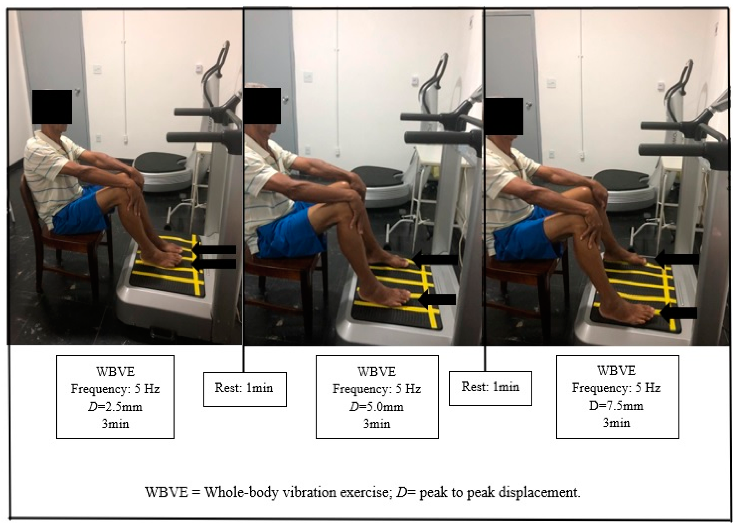 Applied Sciences | Free Full-Text | Acute Effects of Whole-Body Vibration  Exercise on Pain Level, Functionality, and Rating of Exertion of Elderly  Obese Knee Osteoarthritis Individuals: A Randomized Study