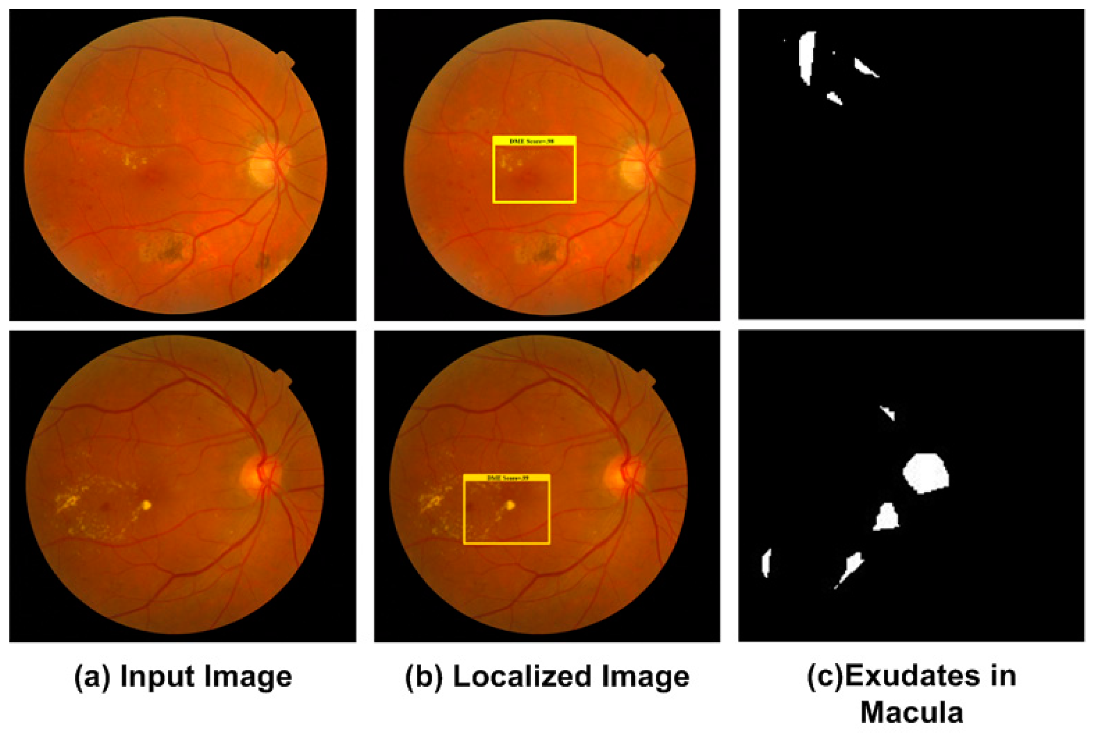 Applied Sciences Free Full Text Retinal Image Analysis For Diabetes Based Eye Disease