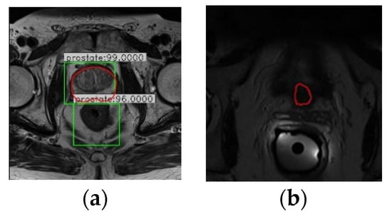 Applied Sciences Free Full Text Cda For Automatic Prostate Segmentation In Mr Images Html