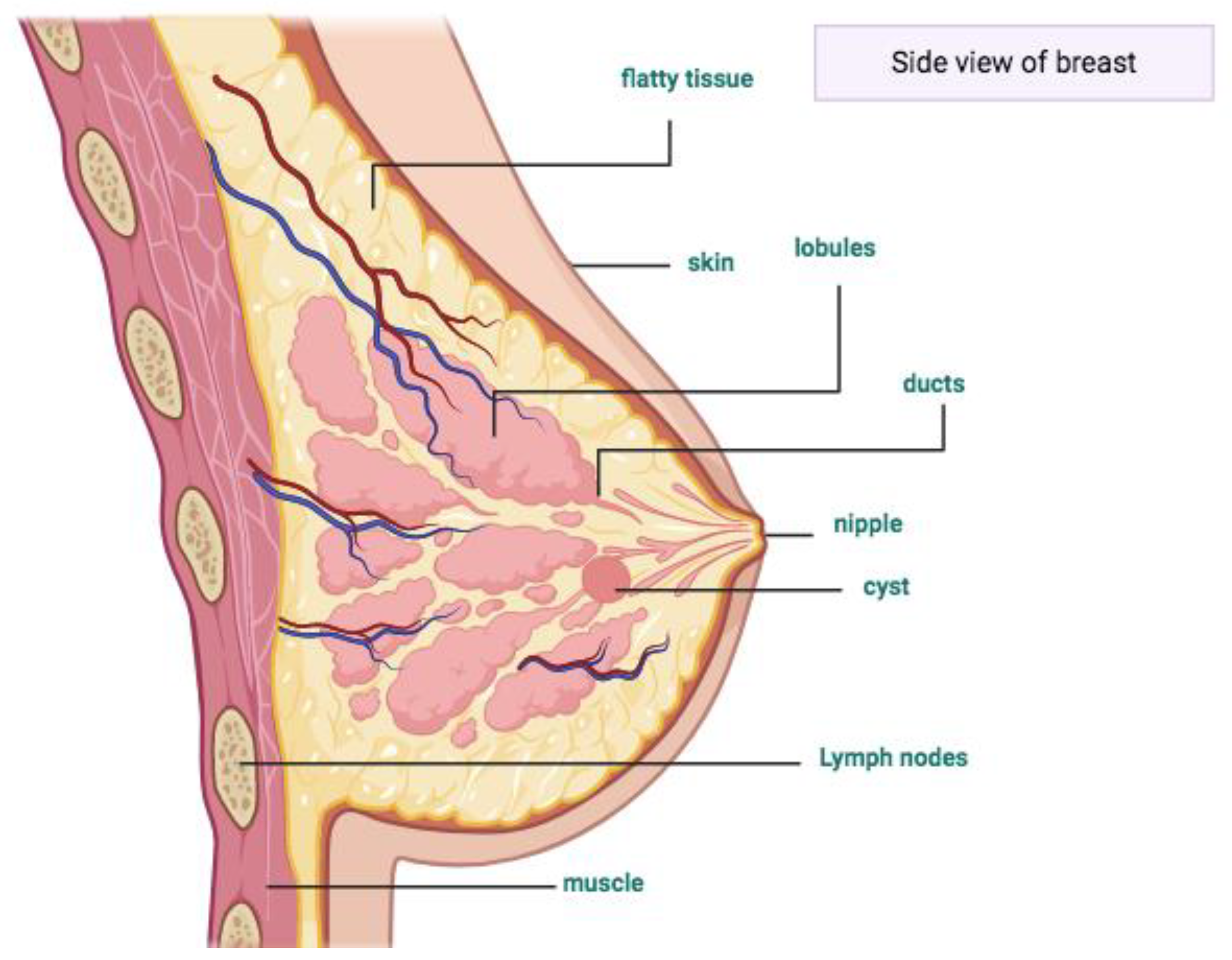 Breast Tumor Size Chart  BioRender Science Templates