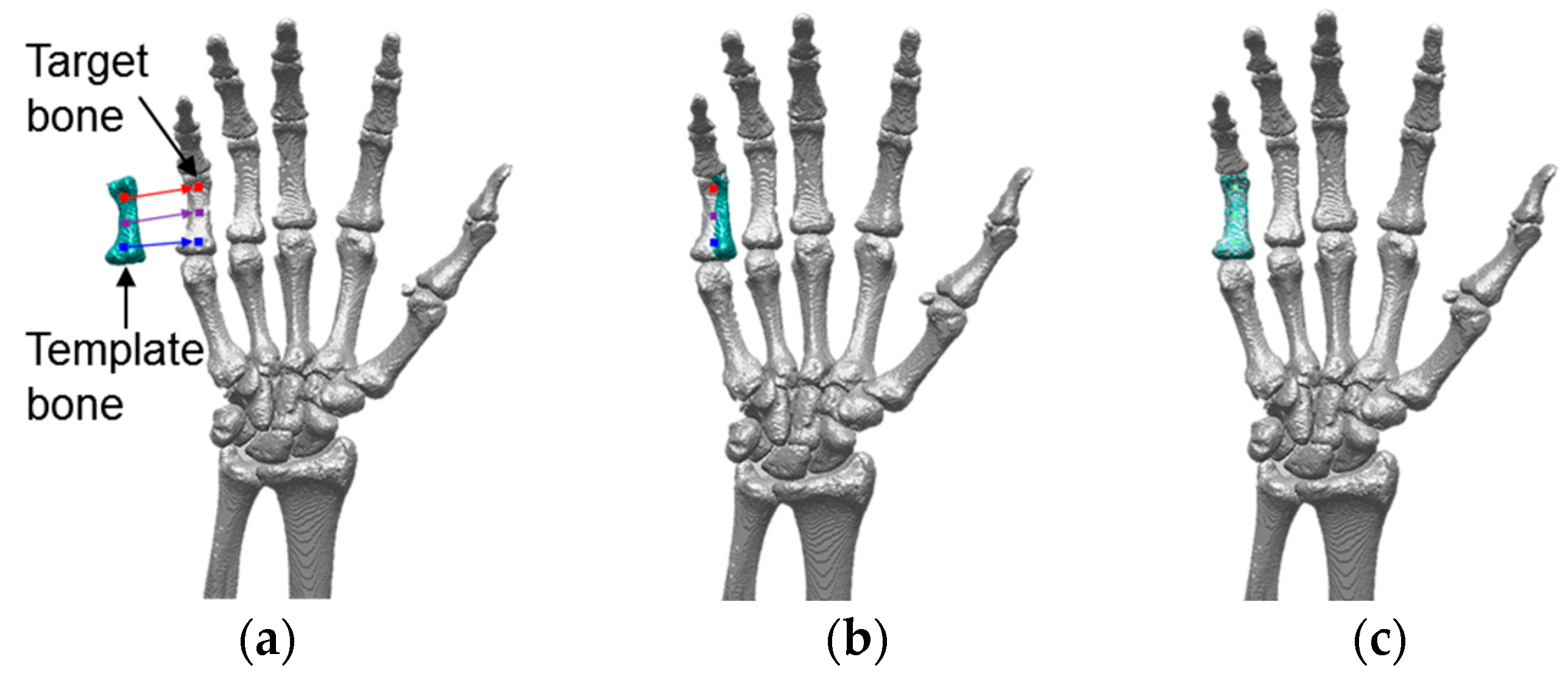 Fingertips rotated about the estimated knuckle poition. Top: Standard