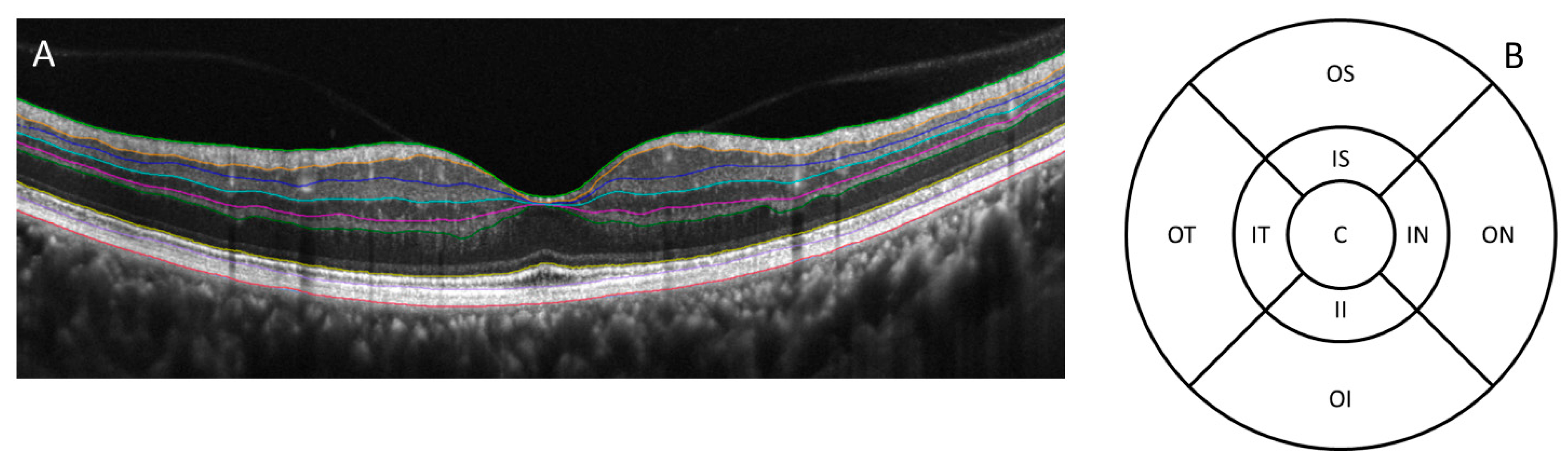 Applsci 11 01250 g001