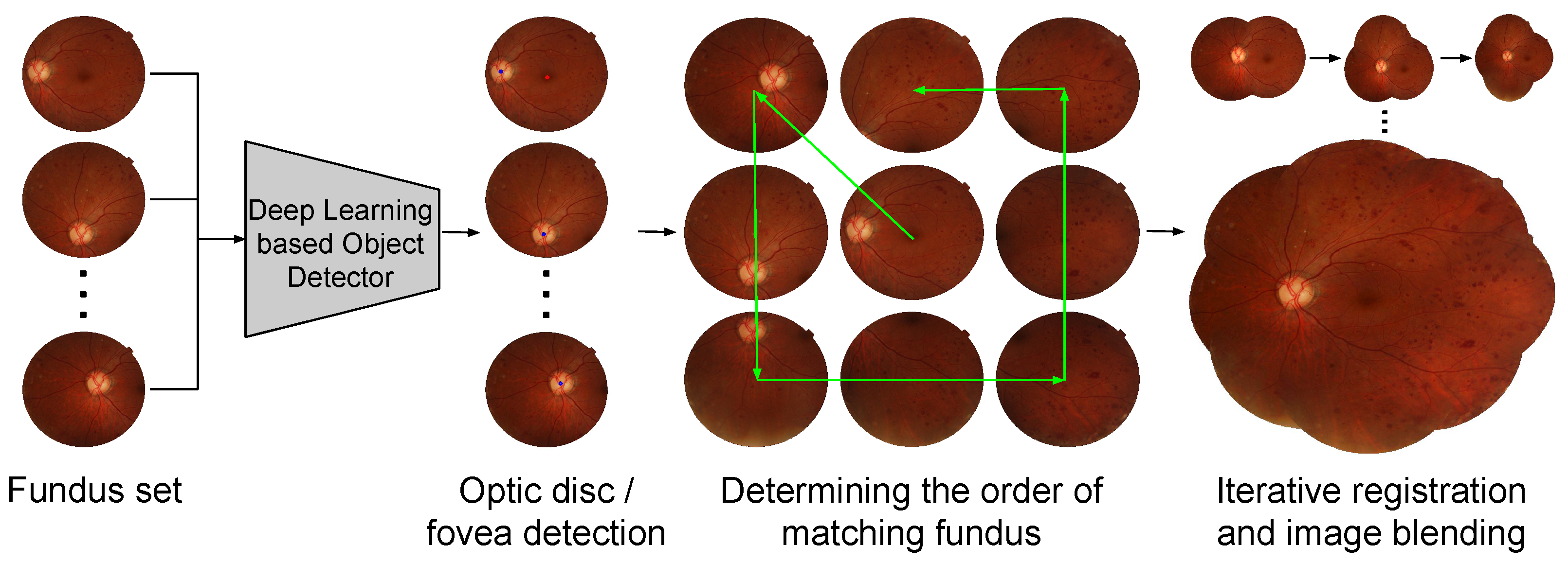 Applied Sciences Free Full Text Fully Leveraging Deep Learning Methods For Constructing Retinal Fundus Photomontages Html