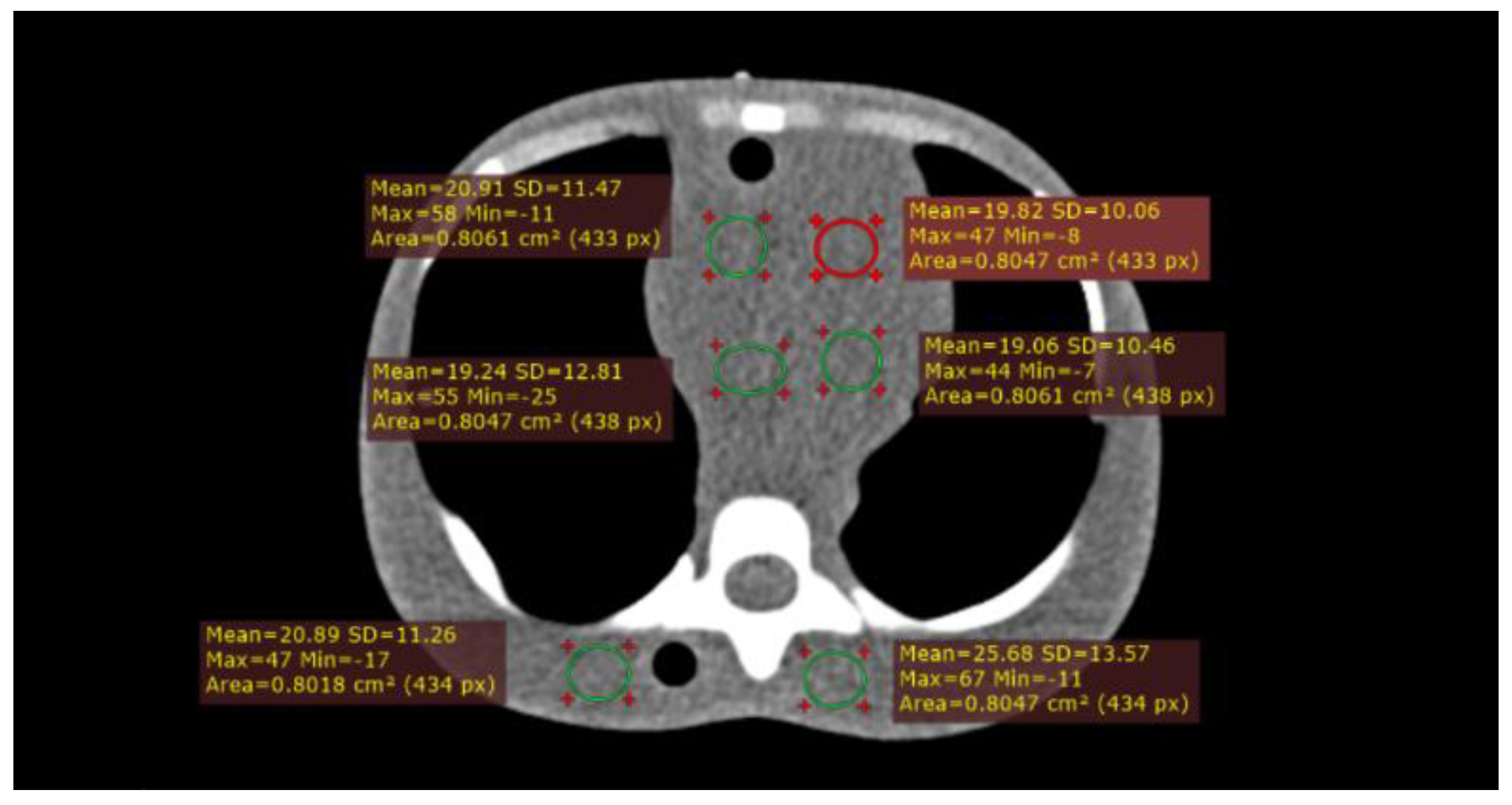 Applied Sciences Free Full Text Evaluation of Organ Dose and