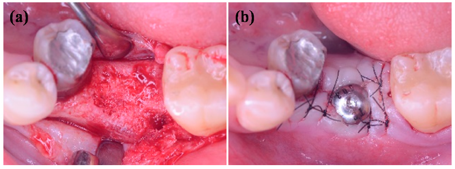 Applsci 11 02616 g001