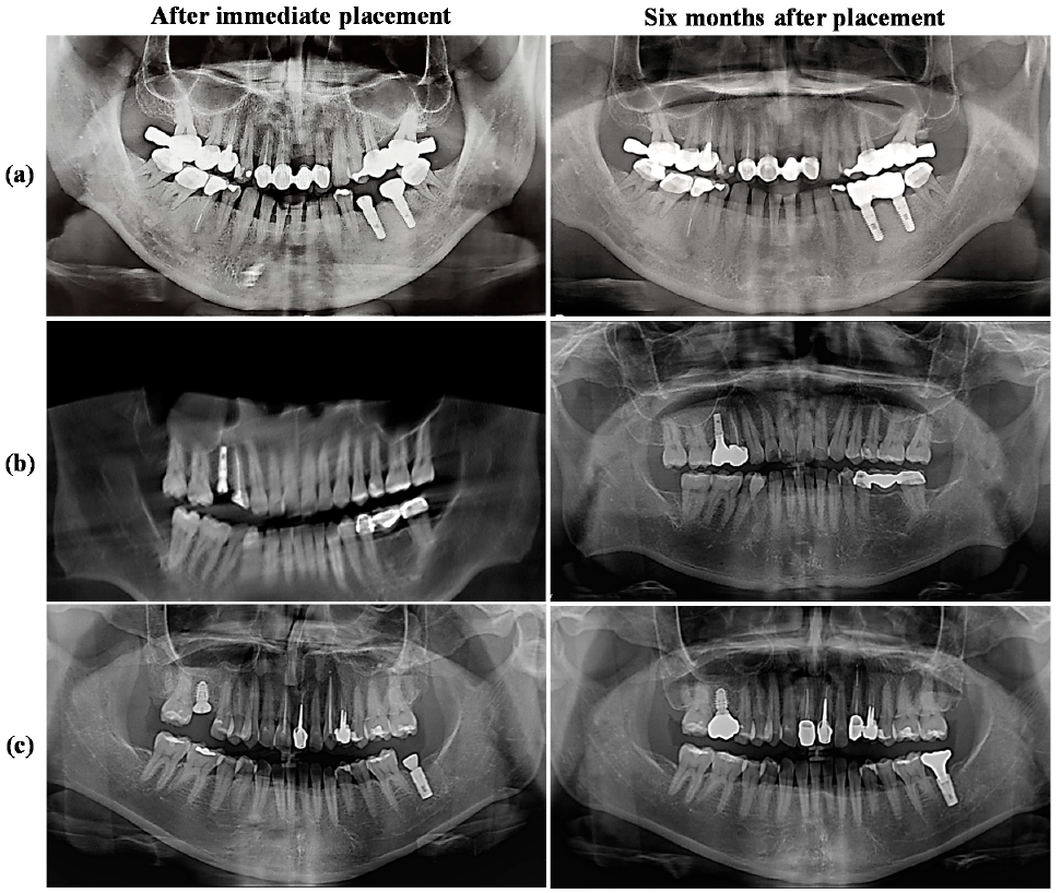 Applsci 11 02616 g007