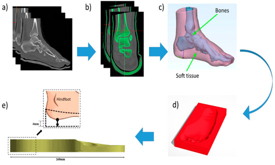 Inner soles sales for neuropathy