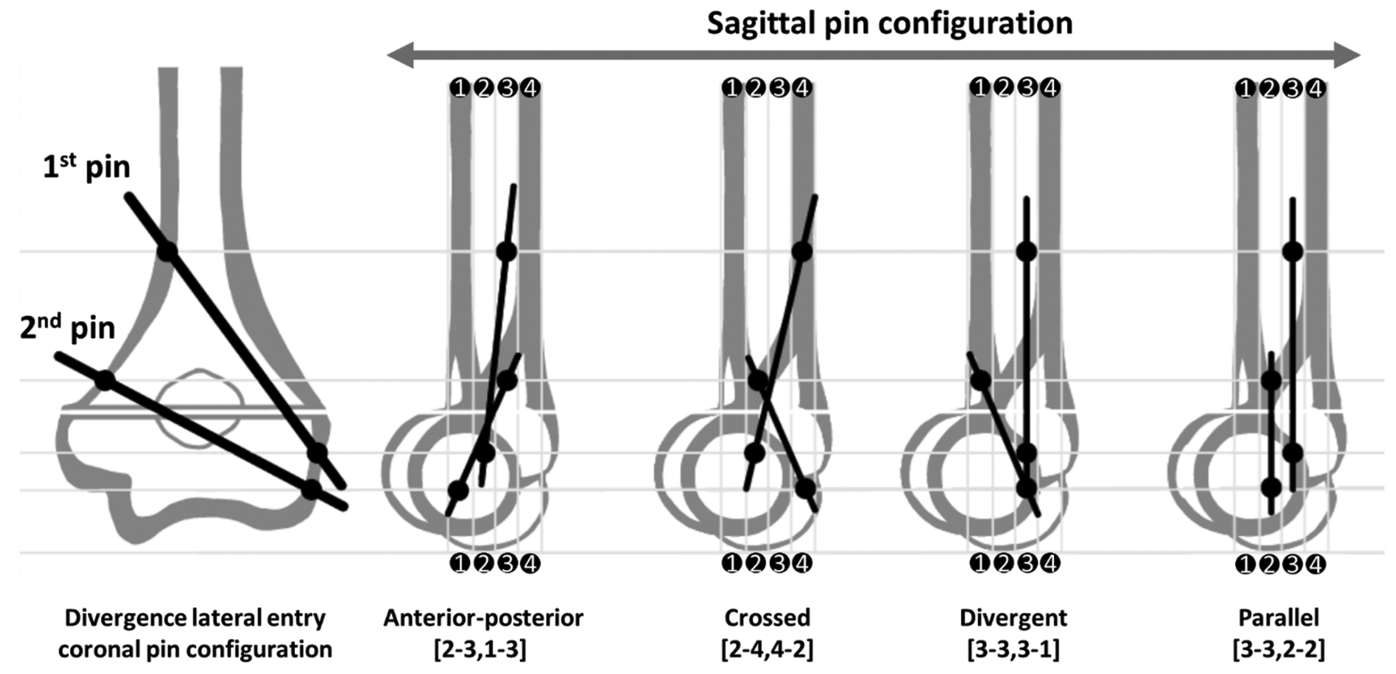 Representative examples of mid-axial and corresponding sagittal