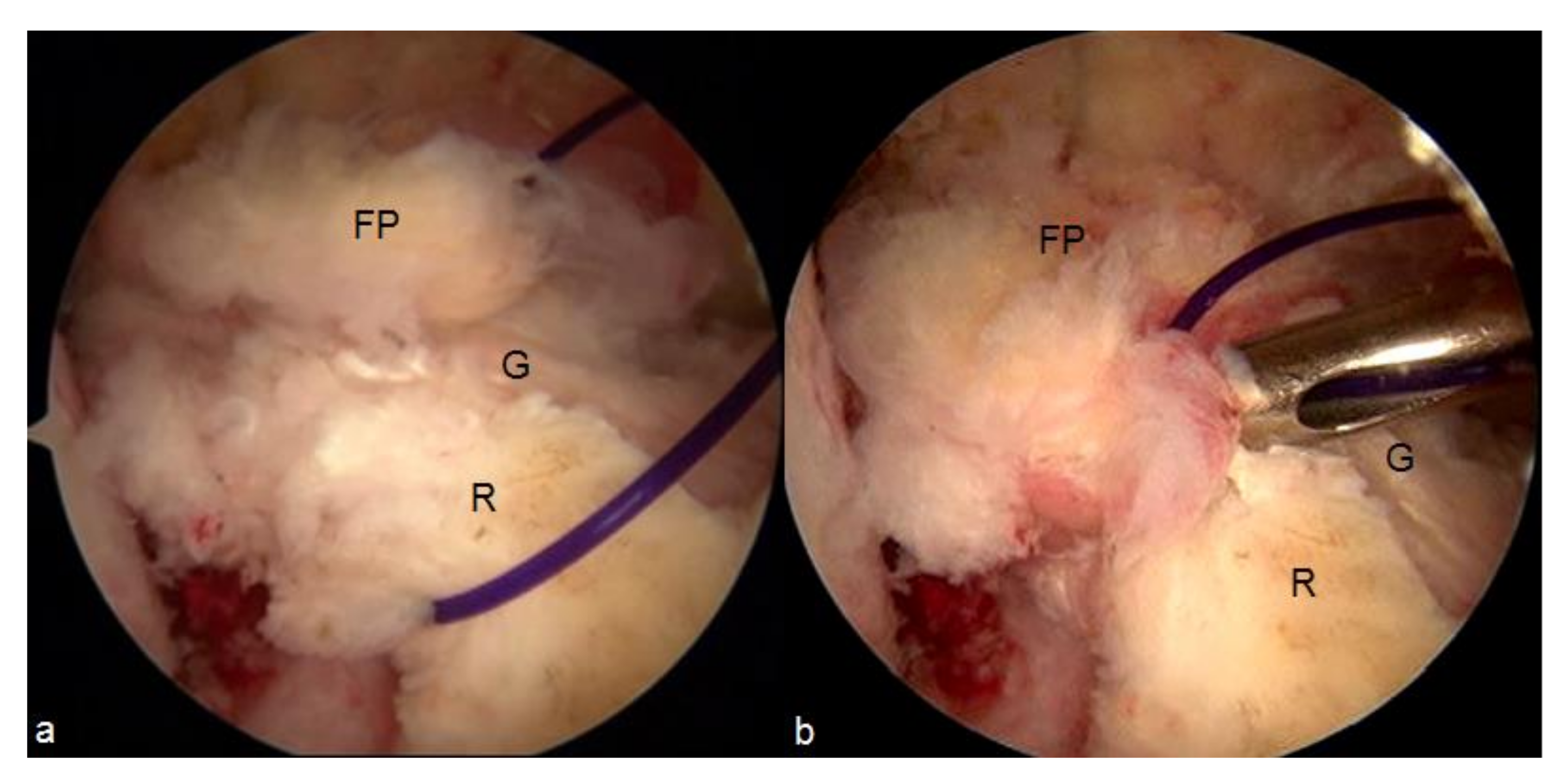 Applsci 11 03597 g005
