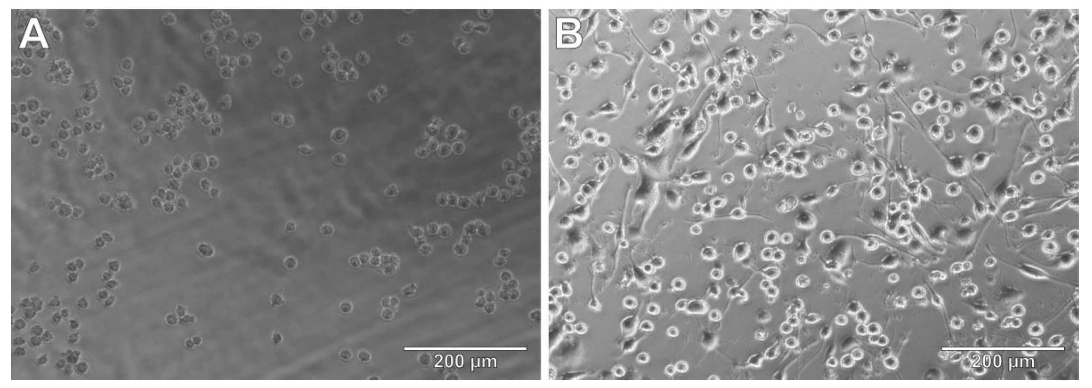 PC12 And THP-1 Cell Lines As Neuronal And Microglia Model In ...