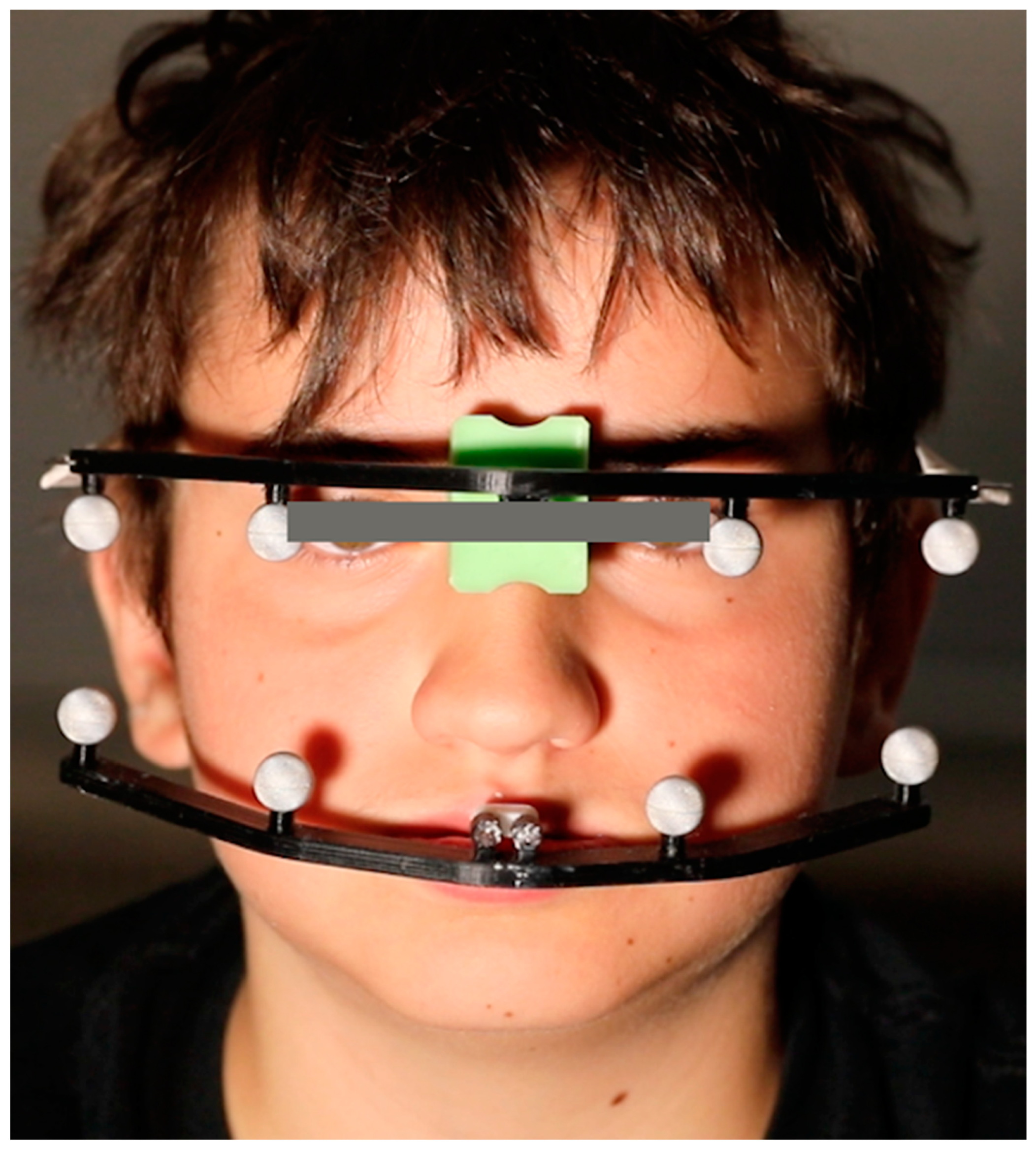 Applsci 11 03947 g002 Applsci 11 03947 g002