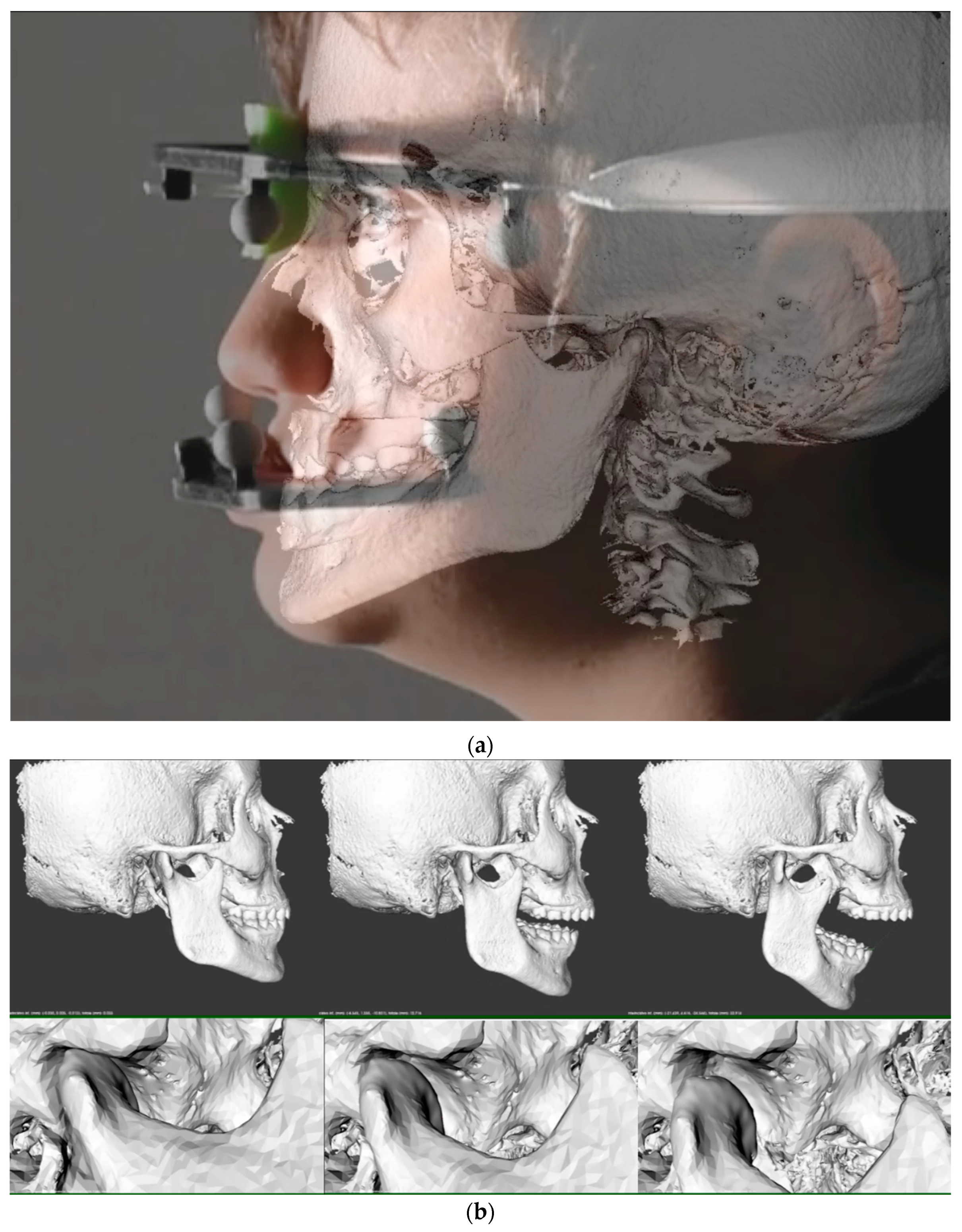 Applsci 11 03947 g004 Applsci 11 03947 g004