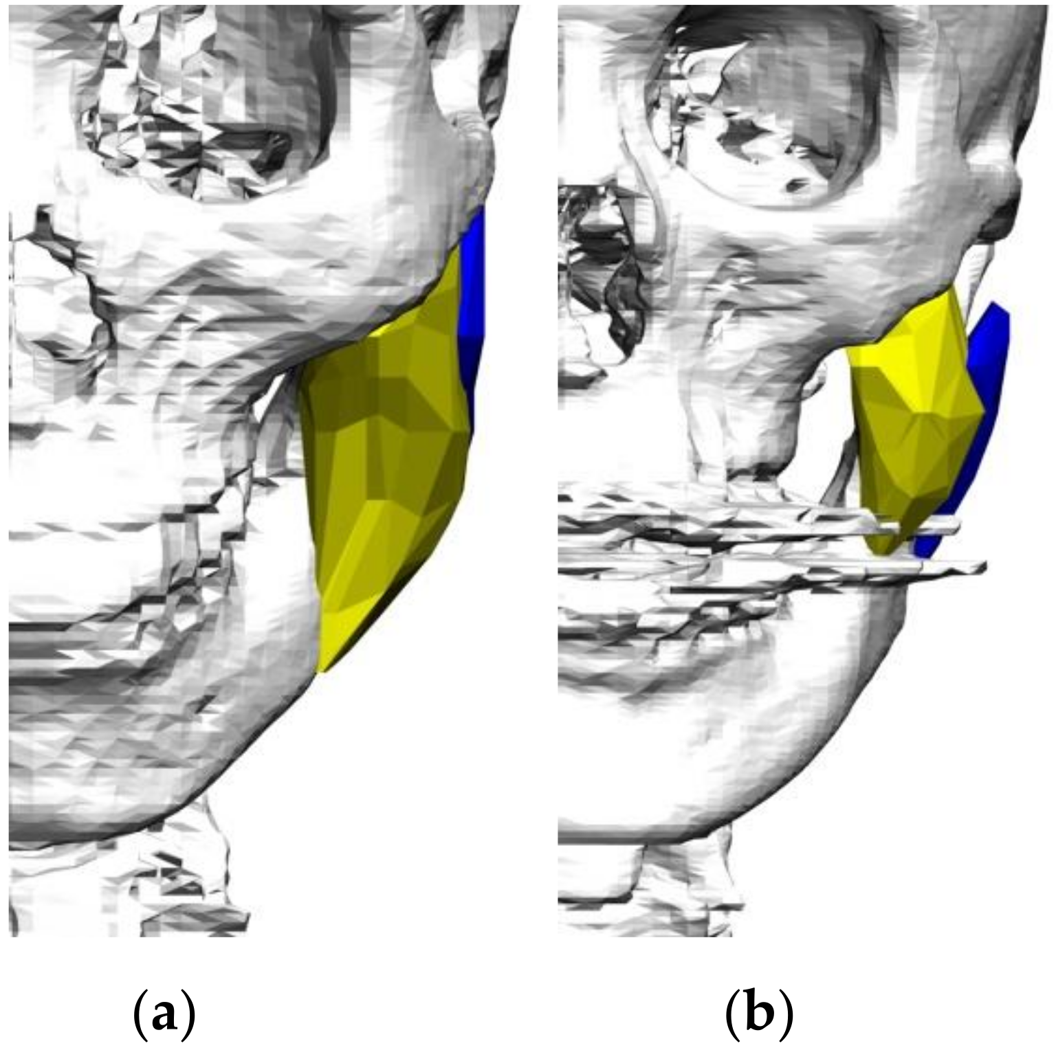 Applsci 11 04444 g002 Applsci 11 04444 g002