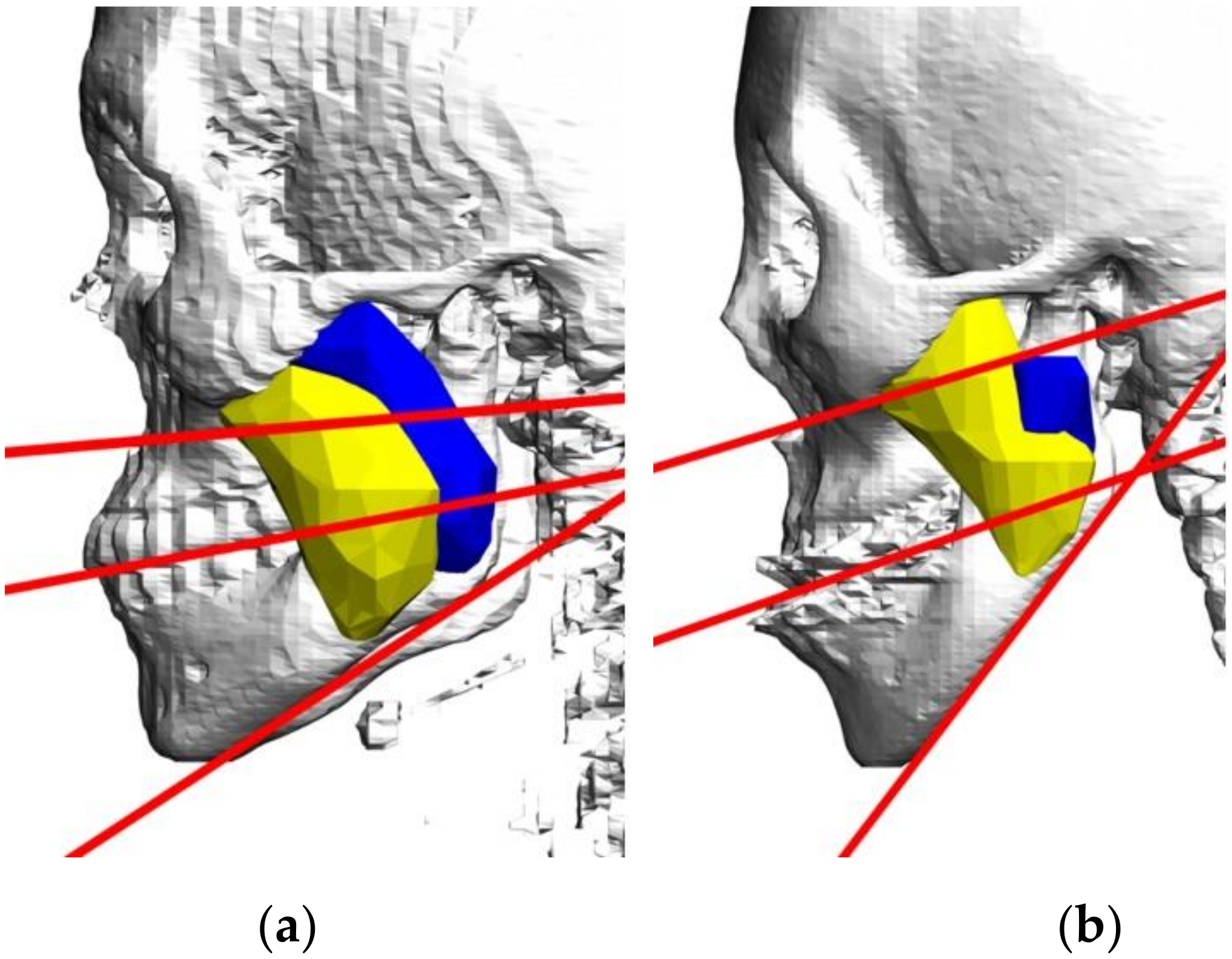 Applsci 11 04444 g003 Applsci 11 04444 g003