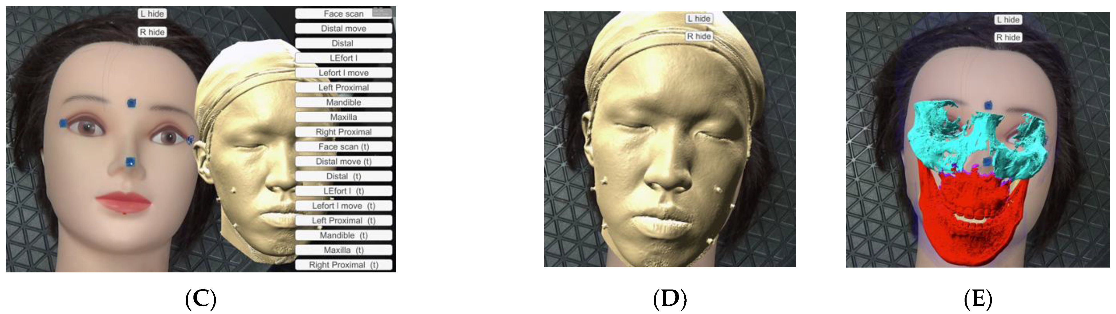 Applsci 11 05673 g004b Applsci 11 05673 g004b