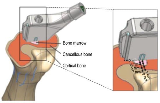 Electrical Stimulation Therapy Colorado Springs, CO - Total