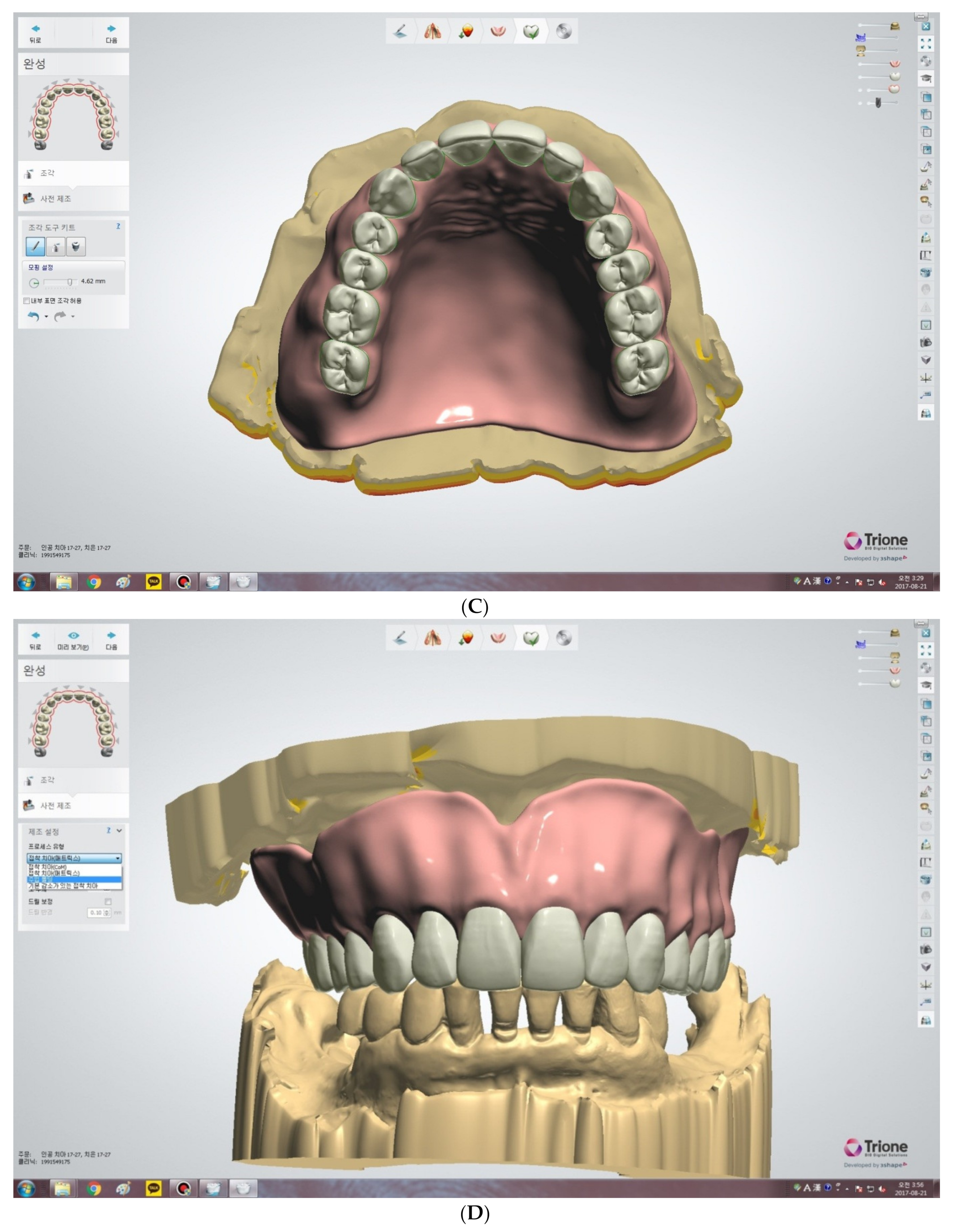 Applied Sciences | Free Full-Text | Digital Denture Fabrication: A